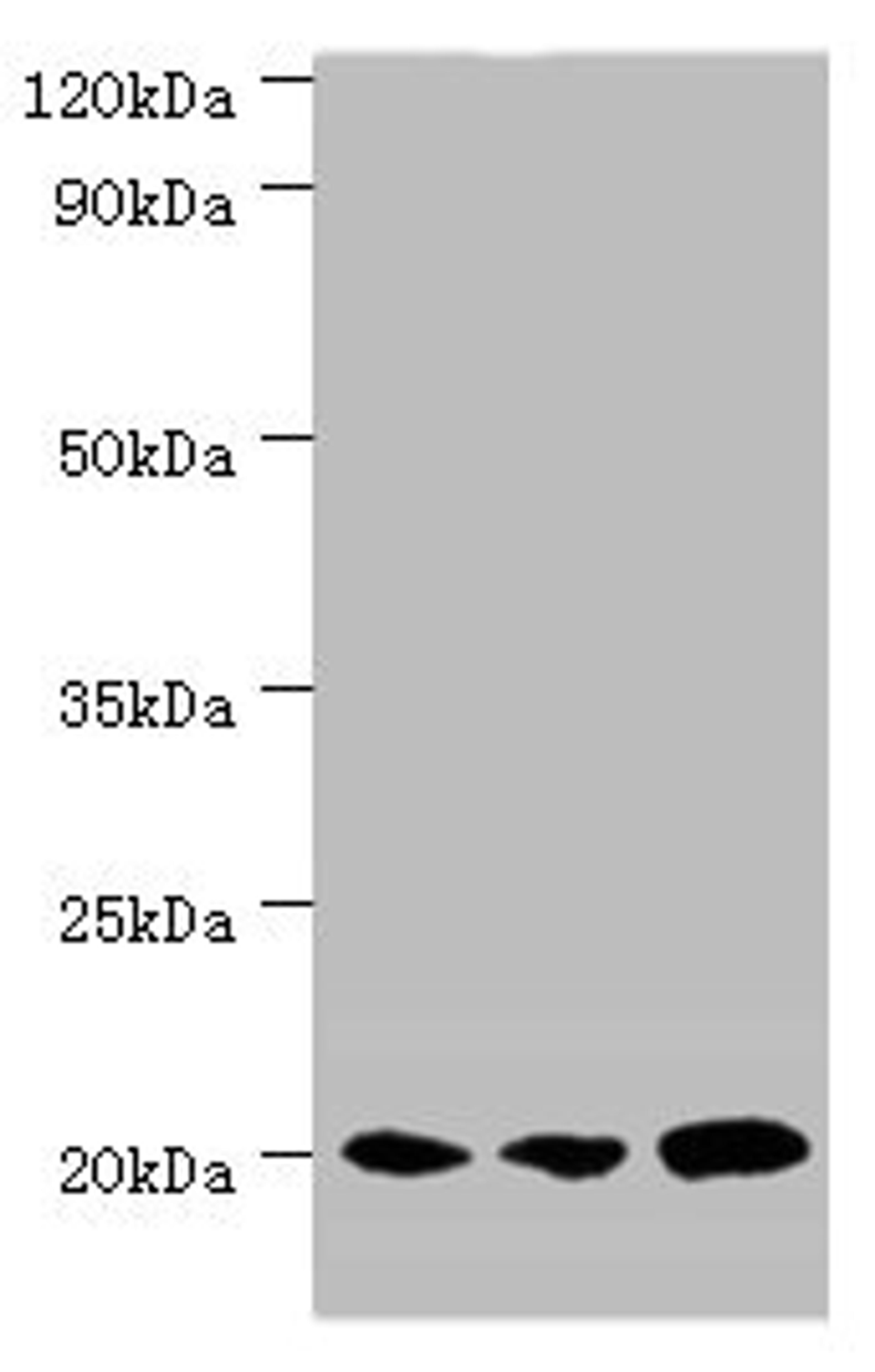 Western blot. All lanes: COX4I1 antibody at 5µg/ml. Lane 1: MCF-7 whole cell lysate. Lane 2: A549 whole cell lysate. Lane 3: HepG2 whole cell lysate. Secondary. Goat polyclonal to rabbit IgG at 1/10000 dilution. Predicted band size: 20 kDa. Observed band size: 20 kDa