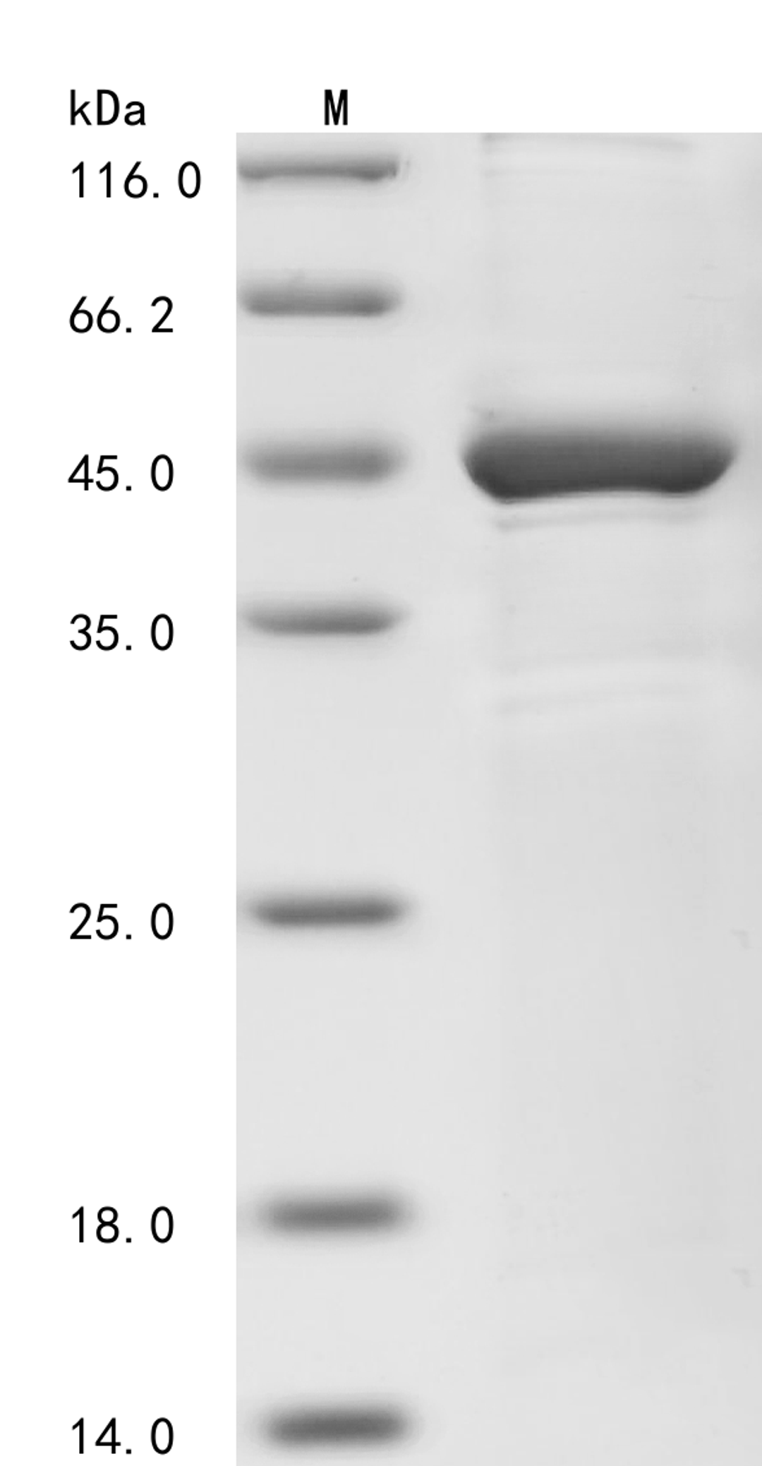 (Tris-Glycine gel) Discontinuous SDS-PAGE (reduced) with 5% enrichment gel and 15% separation gel.