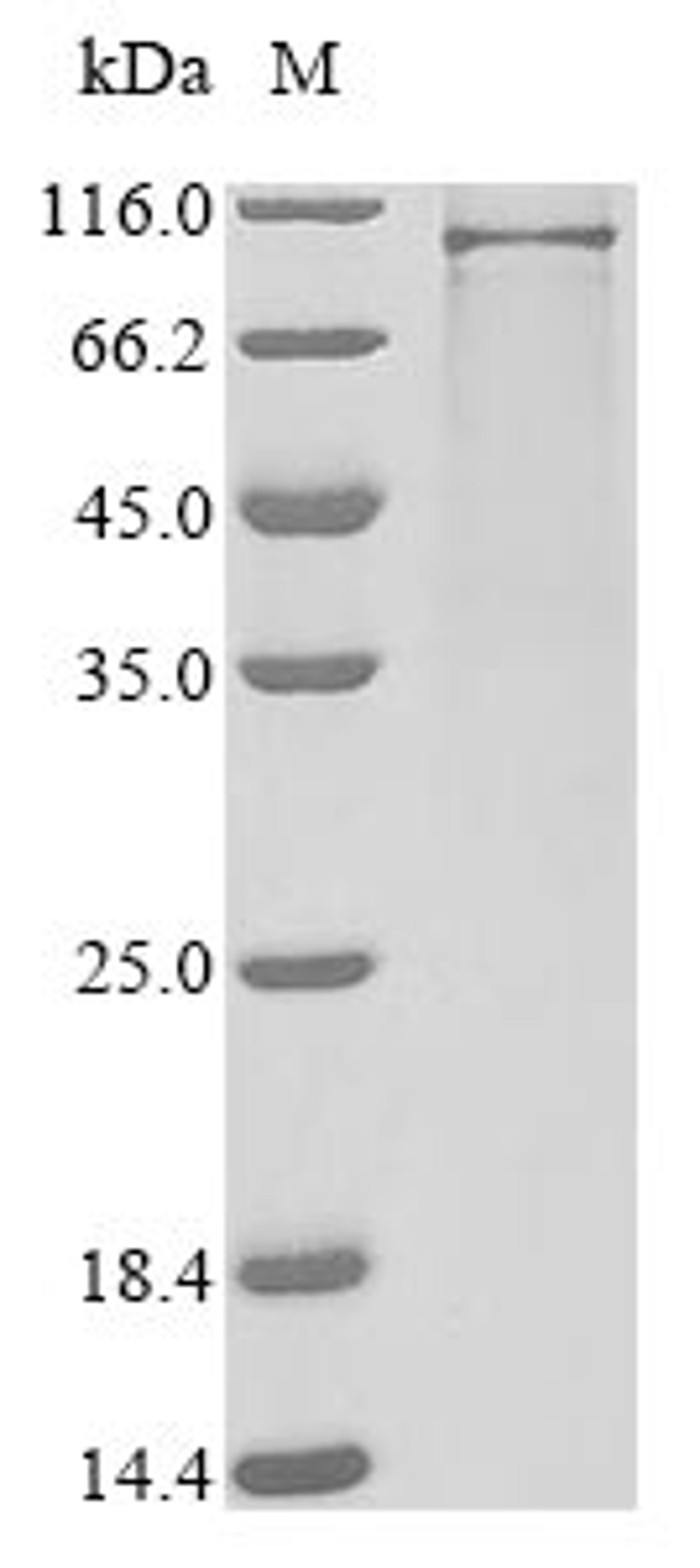 (Tris-Glycine gel) Discontinuous SDS-PAGE (reduced) with 5% enrichment gel and 15% separation gel.