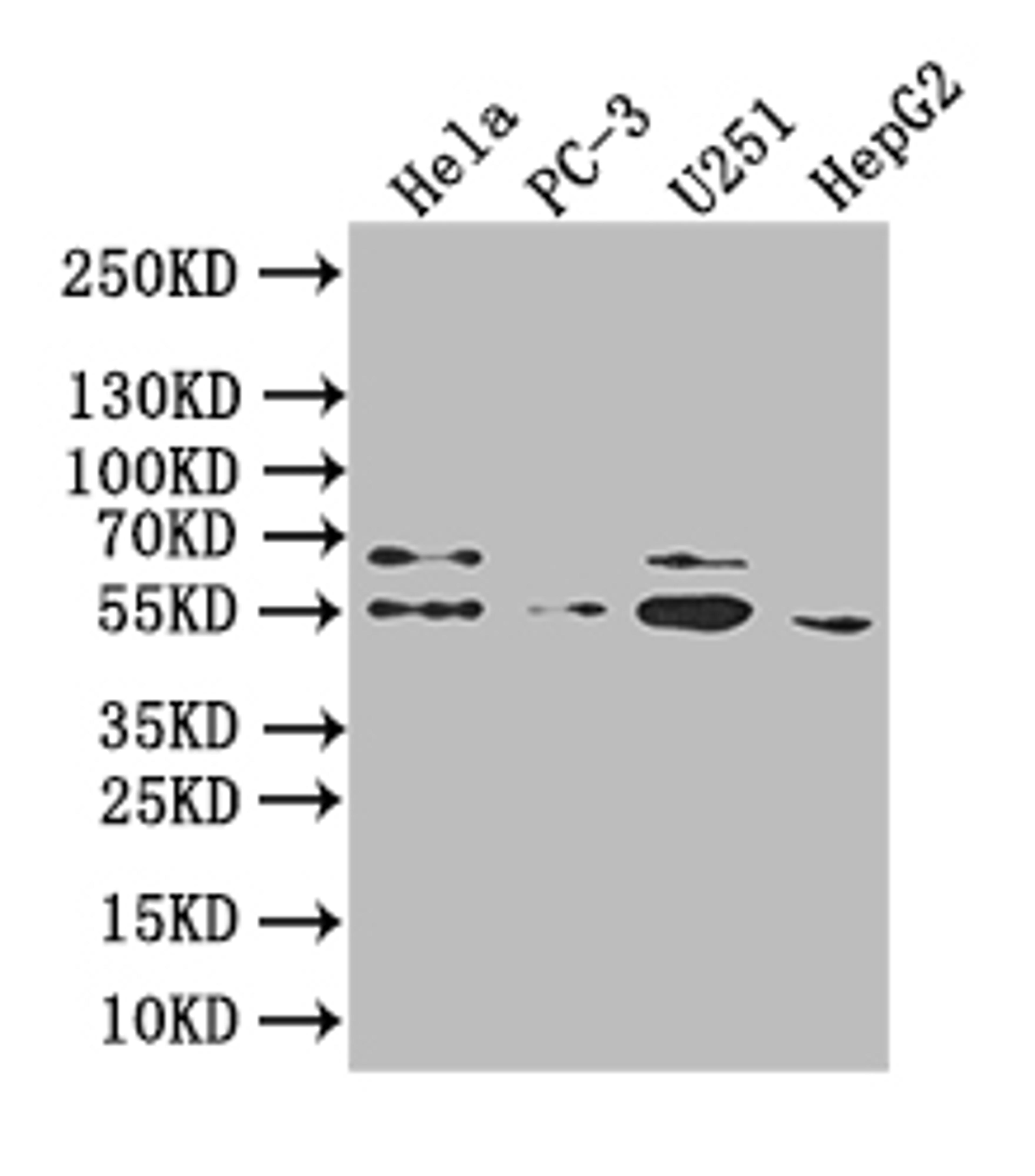 Western Blot. Positive WB detected in:Hela whole cell lysate, PC-3 whole cell lysate, U251 whole cell lysate, HepG2 whole cell lysate. All lanes: GIPR antibody at 1:1000. Secondary. Goat polyclonal to human IgG at 1/50000 dilution. Predicted band size: 54 kDa,49 kDa,50 kDa. Observed band size: 54 kDa.
