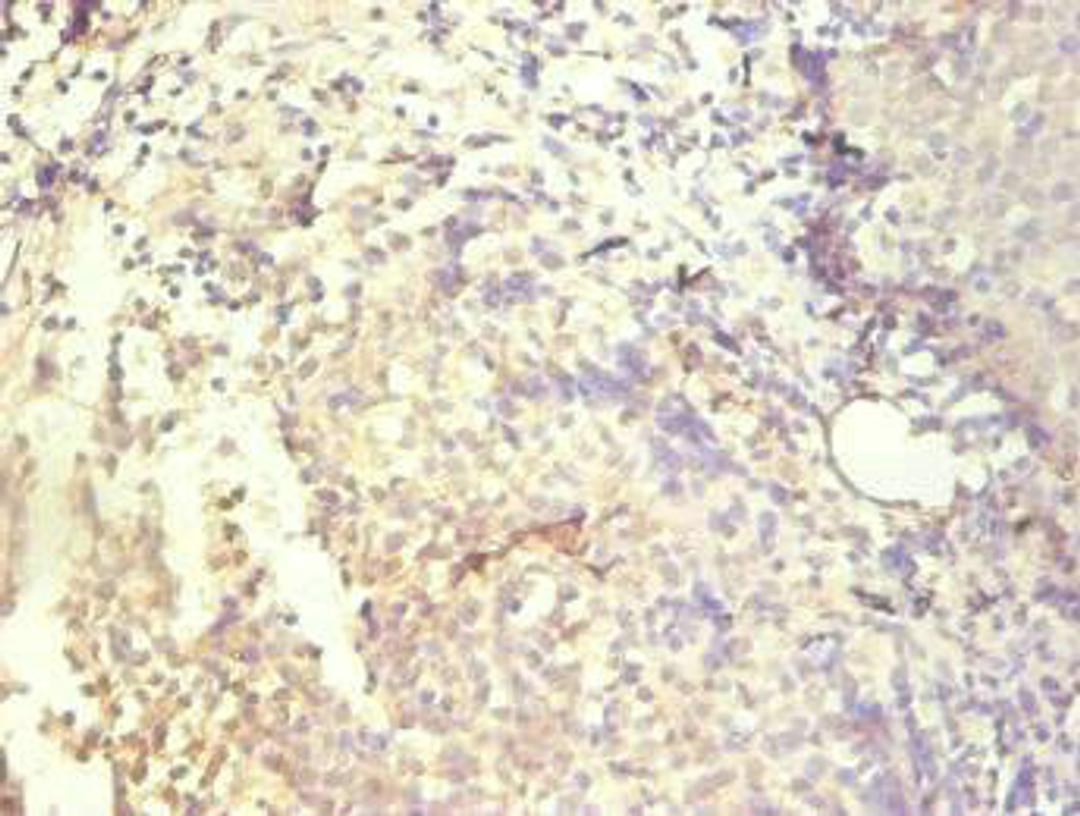 Immunohistochemical of paraffin-embedded human tonsil tissue using CSB-MA083271A0m at dilution of 1:200.