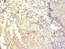 Immunohistochemical of paraffin-embedded human tonsil tissue using CSB-MA083271A0m at dilution of 1:200.