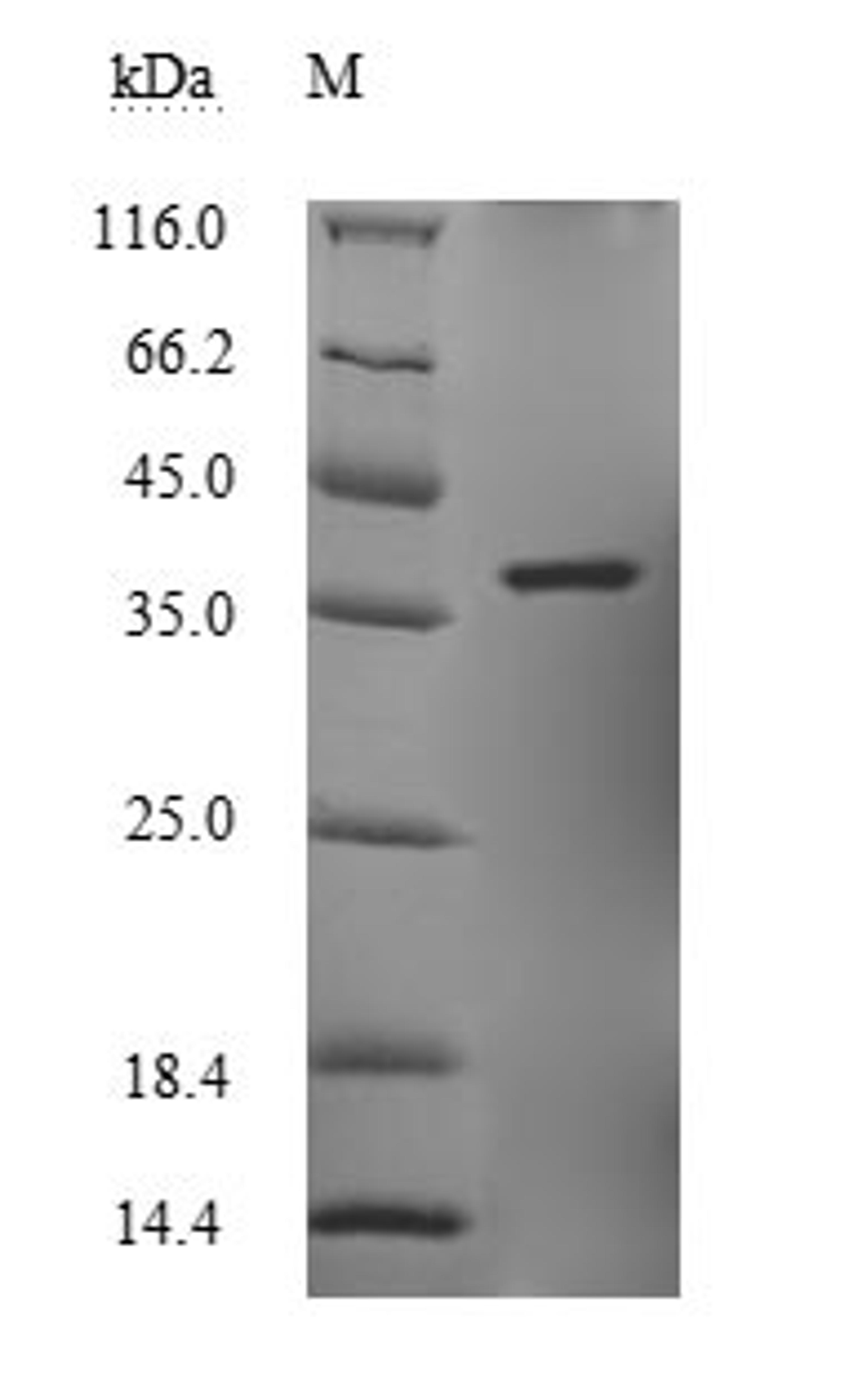 (Tris-Glycine gel) Discontinuous SDS-PAGE (reduced) with 5% enrichment gel and 15% separation gel.