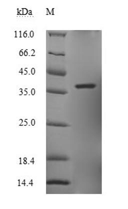 (Tris-Glycine gel) Discontinuous SDS-PAGE (reduced) with 5% enrichment gel and 15% separation gel.