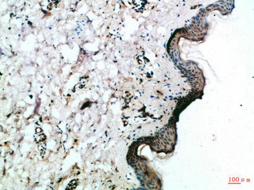 Immunohistochemical analysis of paraffin-embedded Human-skin, antibody was diluted at 1:100