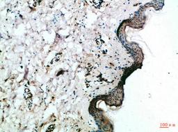 Immunohistochemical analysis of paraffin-embedded Human-skin, antibody was diluted at 1:100