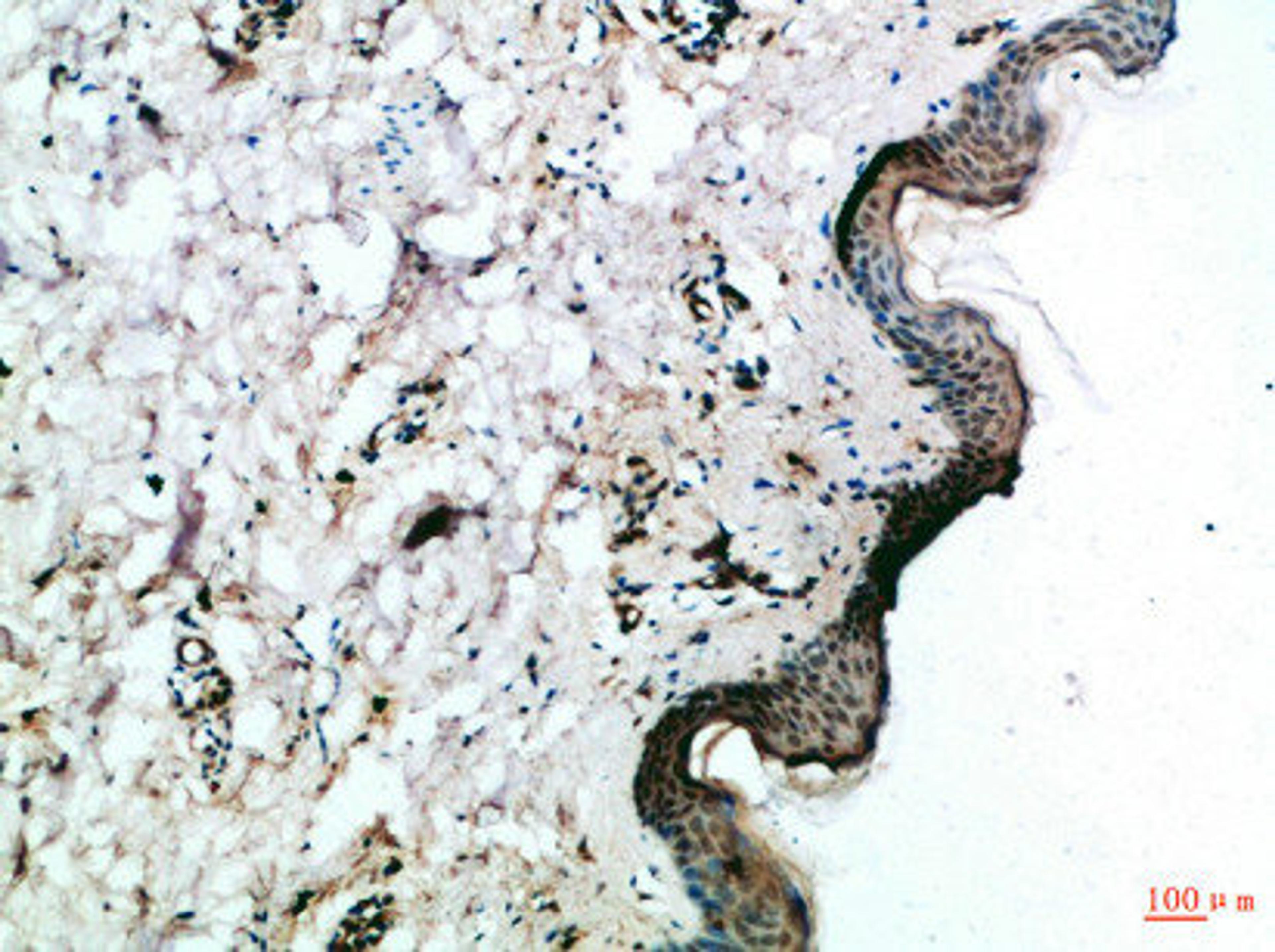 Immunohistochemical analysis of paraffin-embedded Human-skin, antibody was diluted at 1:100