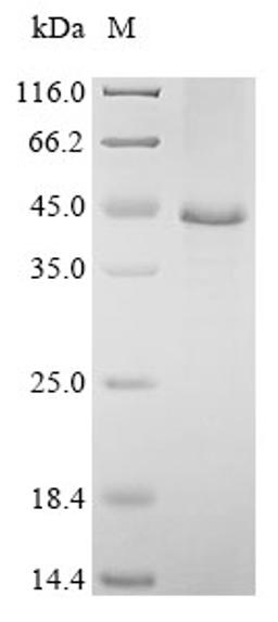 (Tris-Glycine gel) Discontinuous SDS-PAGE (reduced) with 5% enrichment gel and 15% separation gel.