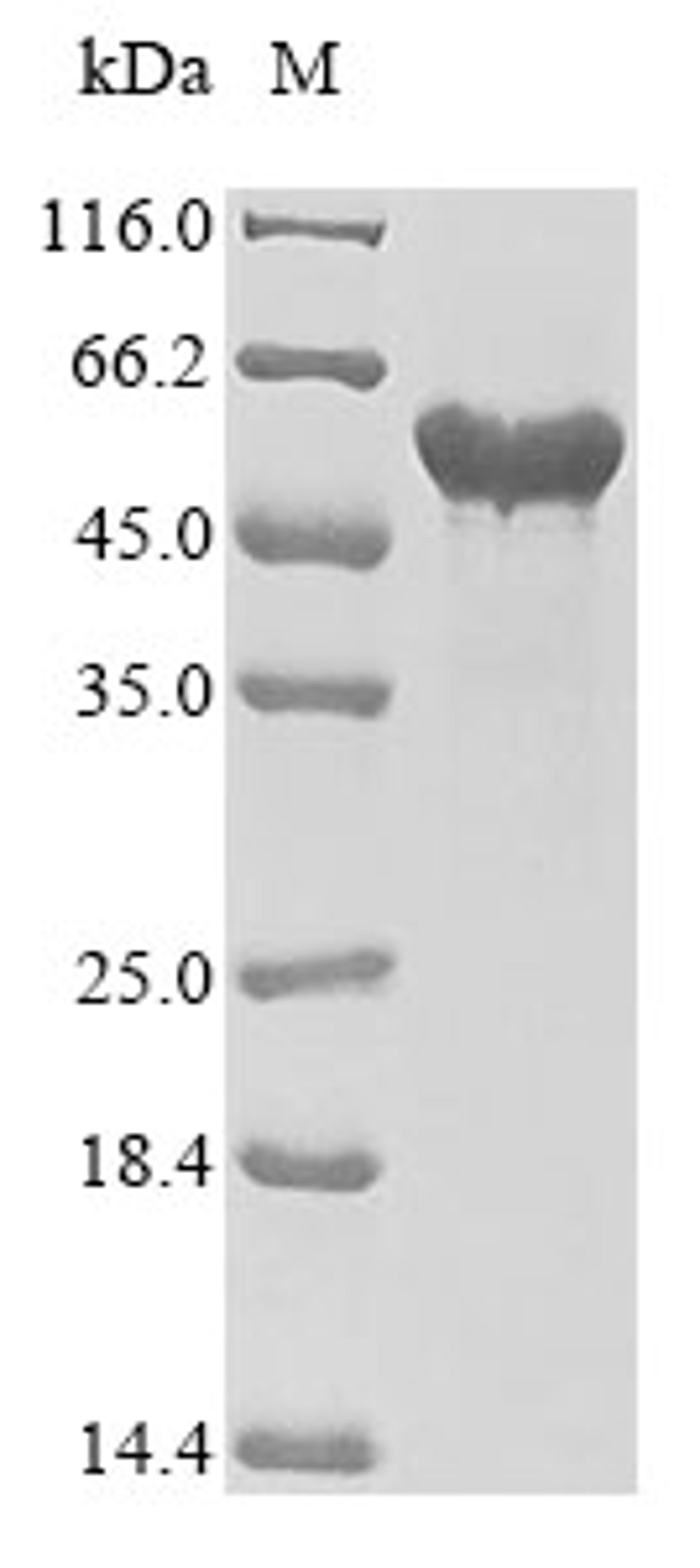 (Tris-Glycine gel) Discontinuous SDS-PAGE (reduced) with 5% enrichment gel and 15% separation gel.