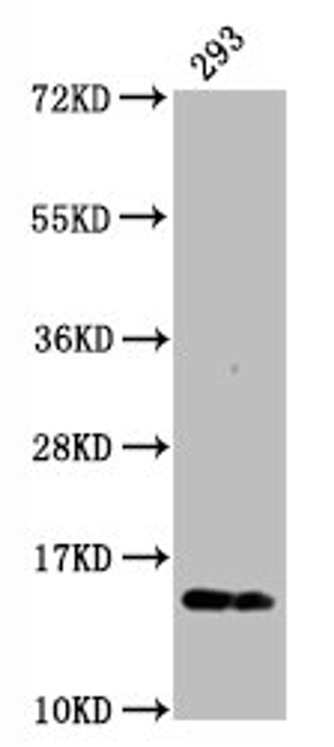 Western Blot. Positive WB detected in:293 whole cell lysate. All lanes:Phospho-Histone H2AX (S139) antibody at 0.23μg/ml. Secondary. Goat polyclonal to rabbit IgG at 1/50000 dilution. Predicted band size: 15 KDa. Observed band size: 15 KDa