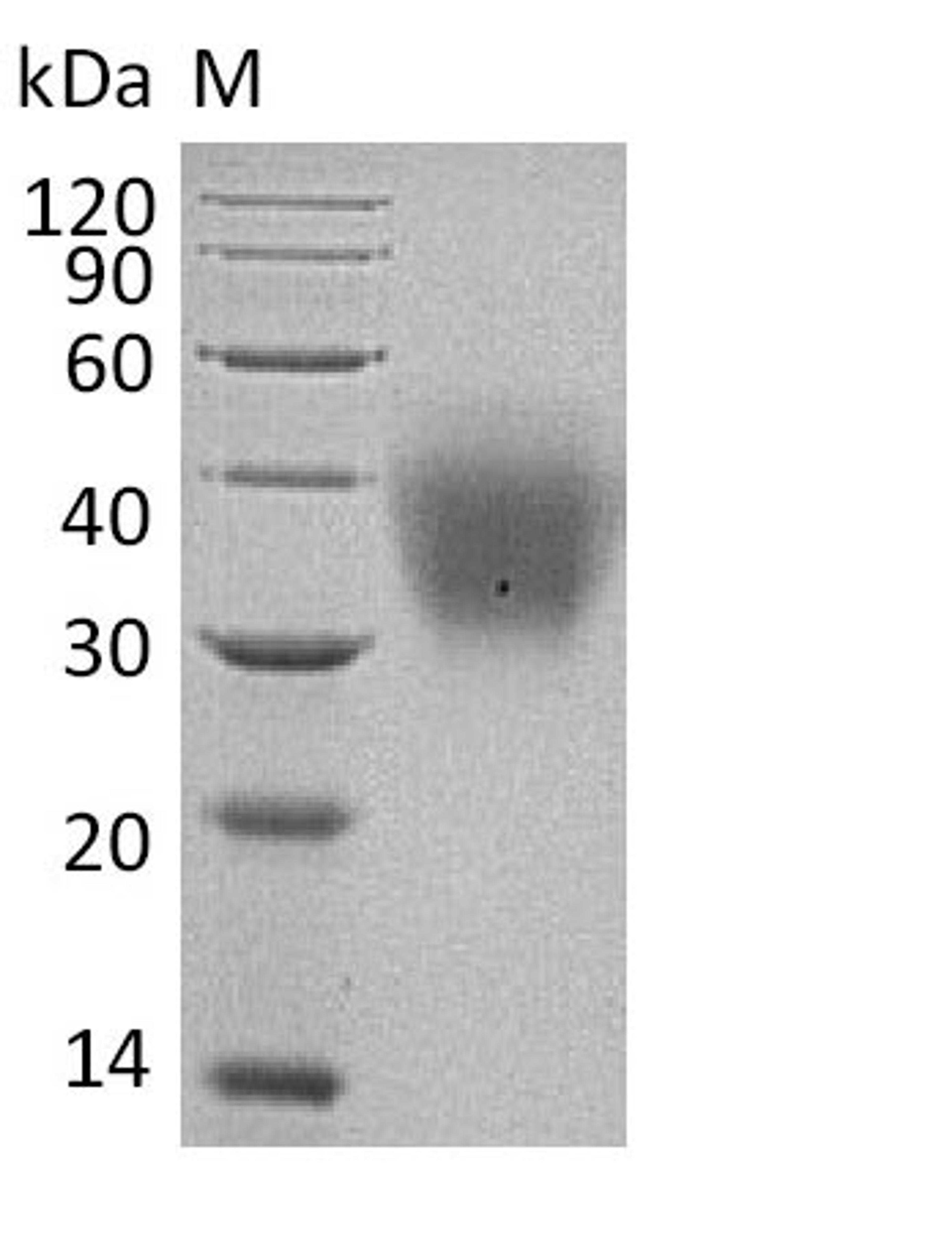 (Tris-Glycine gel) Discontinuous SDS-PAGE (reduced) with 5% enrichment gel and 15% separation gel.