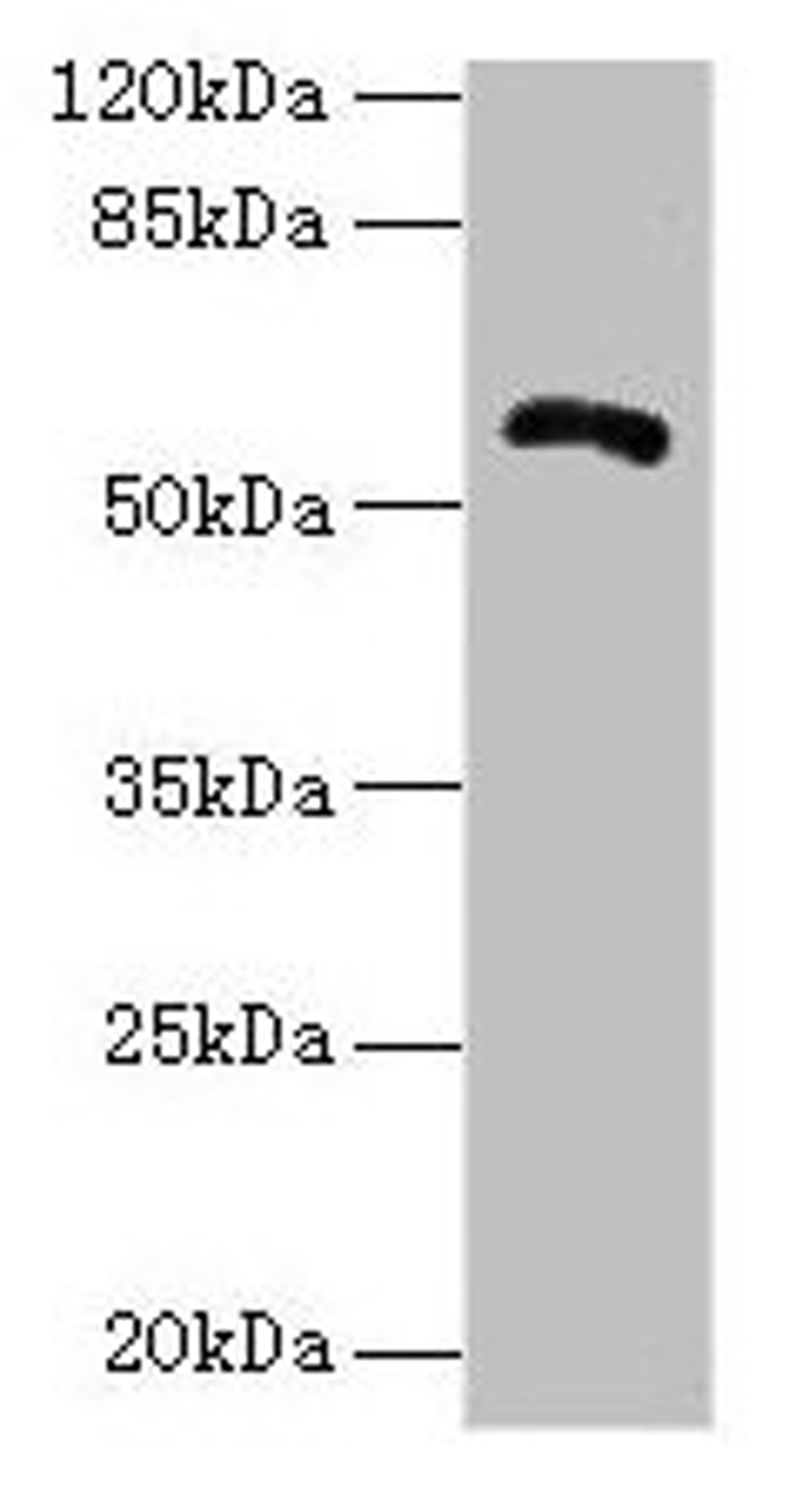 Western blot. All lanes: ZBTB18 antibody at 14µg/ml + Hela whole cell lysate. Secondary. Goat polyclonal to rabbit IgG at 1/10000 dilution. Predicted band size: 59, 60 kDa. Observed band size: 59 kDa