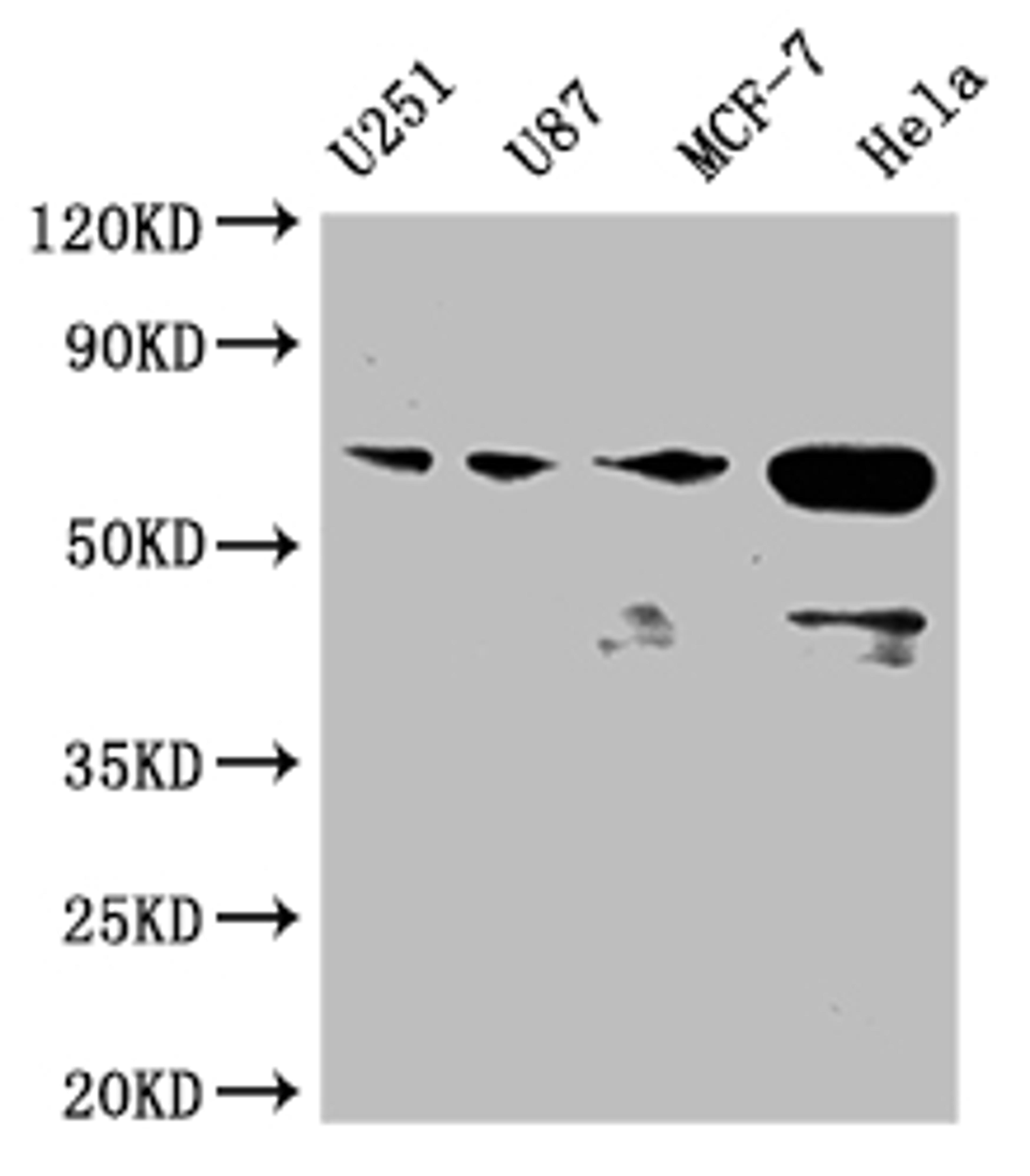 Western Blot. Positive WB detected in: U251 whole cell lysate, U87 whole cell lysate, MCF-7 whole cell lysate, Hela whole cell lysate. All lanes: STK3 antibody at 1:2000. Secondary. Goat polyclonal to rabbit IgG at 1/50000 dilution. Predicted band size: 57, 60 kDa. Observed band size: 50-70 kDa. 