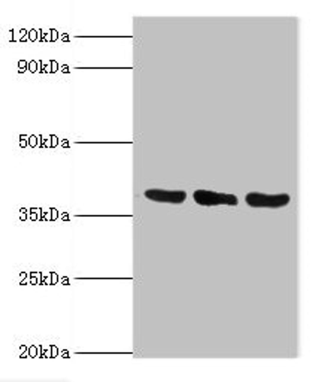 Western blot. All lanes: TMOD3 antibody at 5ug/ml. Lane 1: Jurkat whole cell lysate. Lane 2: MCF-7 whole cell lysate. Lane 3: Hela whole cell lysate. Secondary. Goat polyclonal to rabbit IgG at 1/10000 dilution. Predicted band size: 40 kDa. Observed band size: 40 kDa. 