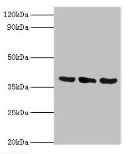 Western blot. All lanes: TMOD3 antibody at 5ug/ml. Lane 1: Jurkat whole cell lysate. Lane 2: MCF-7 whole cell lysate. Lane 3: Hela whole cell lysate. Secondary. Goat polyclonal to rabbit IgG at 1/10000 dilution. Predicted band size: 40 kDa. Observed band size: 40 kDa. 