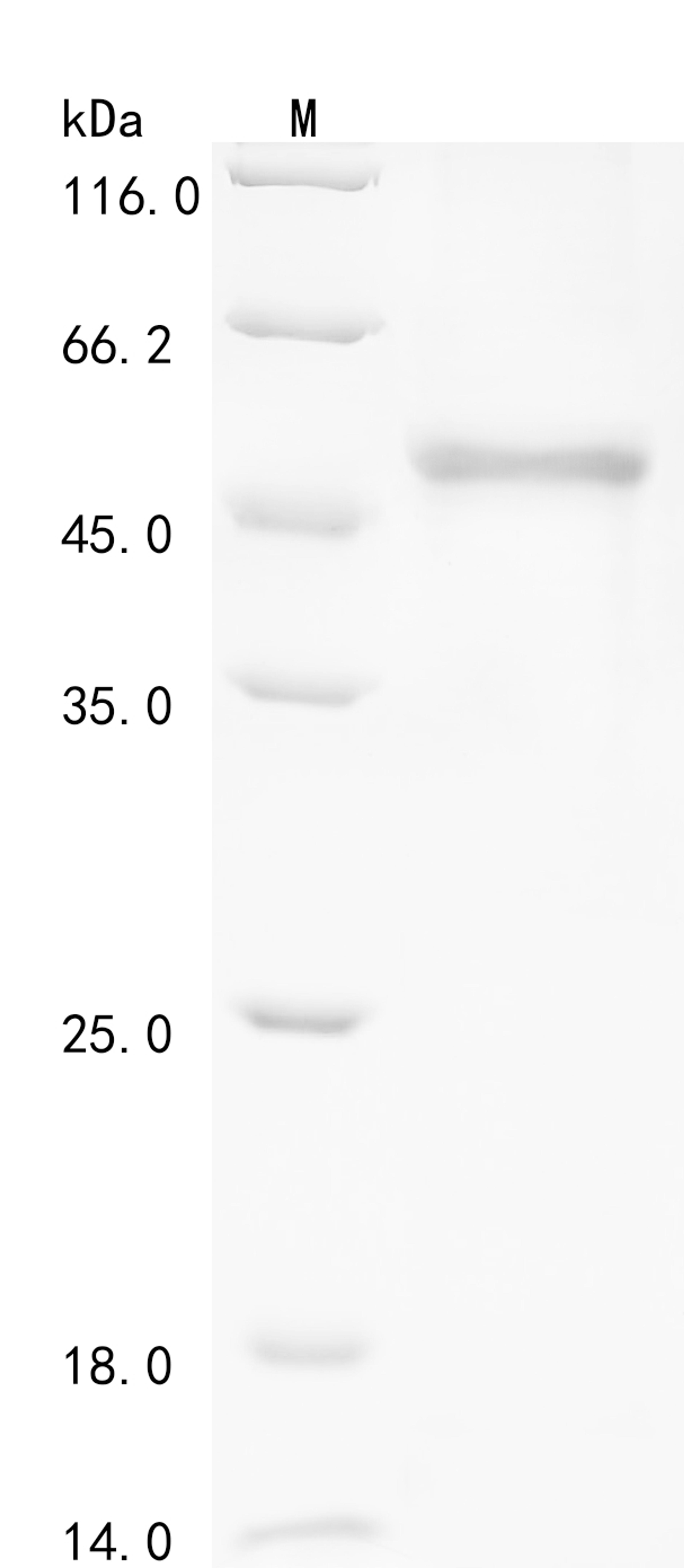 (Tris-Glycine gel) Discontinuous SDS-PAGE (reduced) with 5% enrichment gel and 15% separation gel.