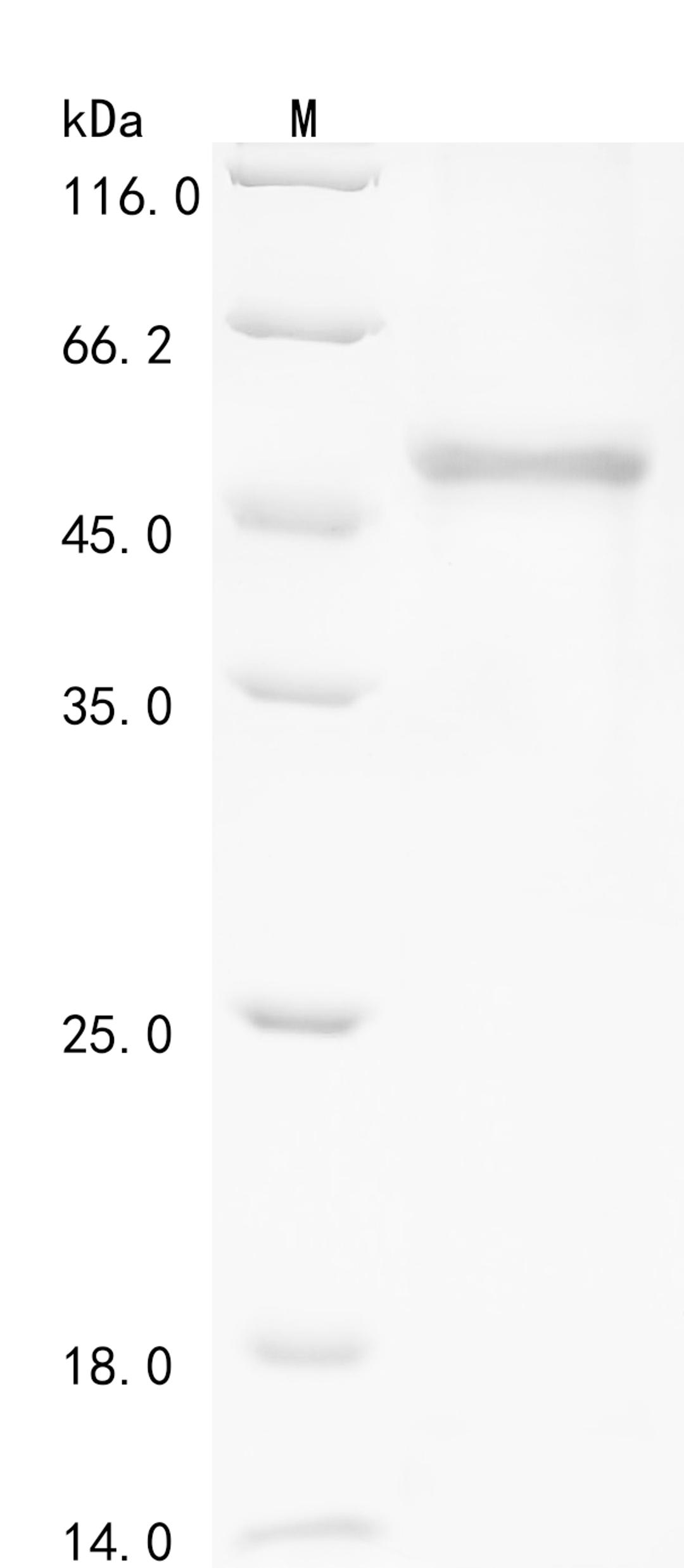 (Tris-Glycine gel) Discontinuous SDS-PAGE (reduced) with 5% enrichment gel and 15% separation gel.