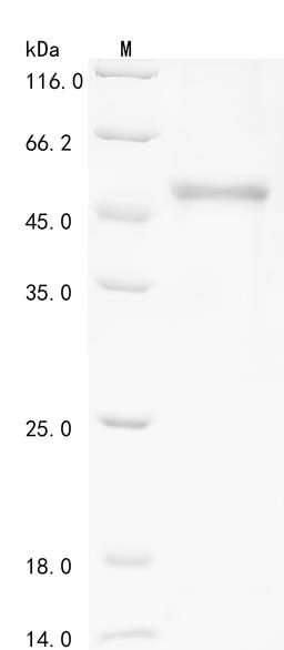 (Tris-Glycine gel) Discontinuous SDS-PAGE (reduced) with 5% enrichment gel and 15% separation gel.