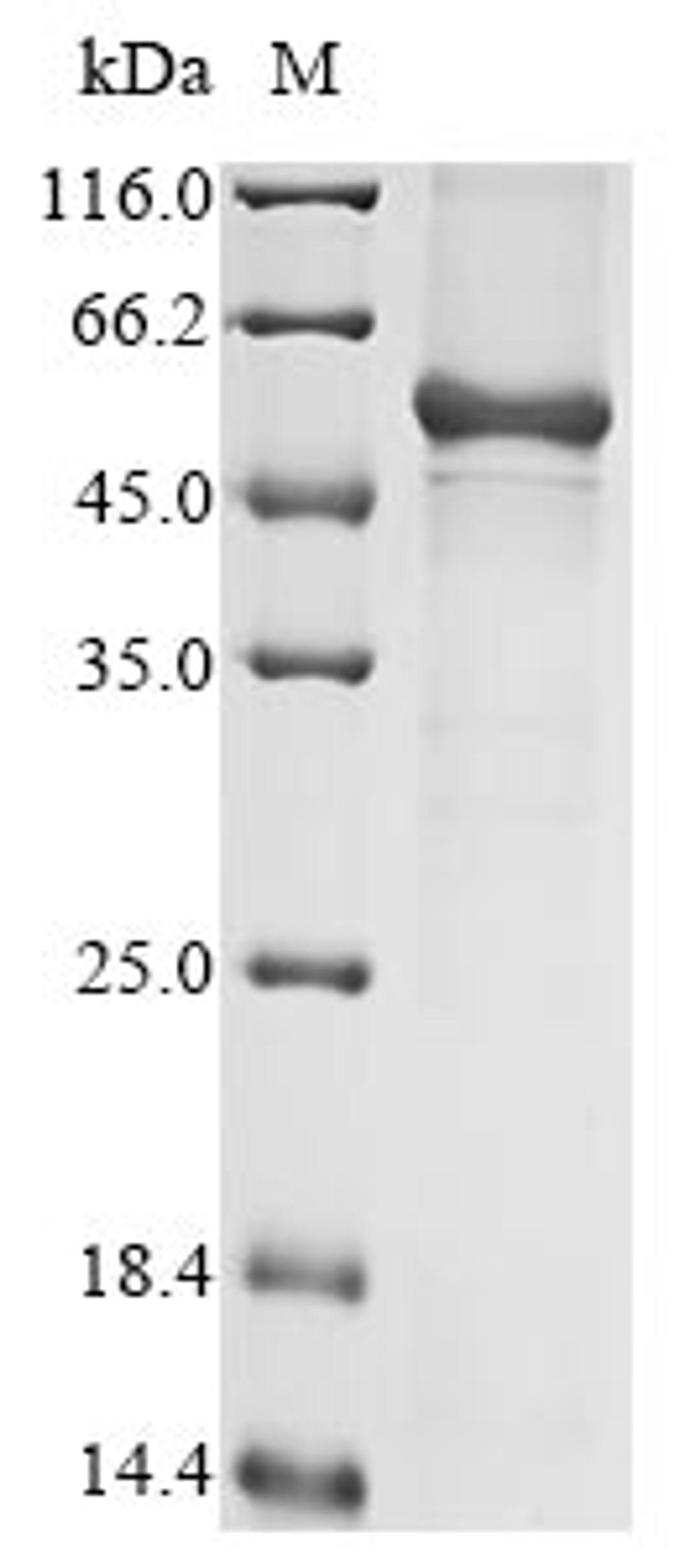 (Tris-Glycine gel) Discontinuous SDS-PAGE (reduced) with 5% enrichment gel and 15% separation gel.