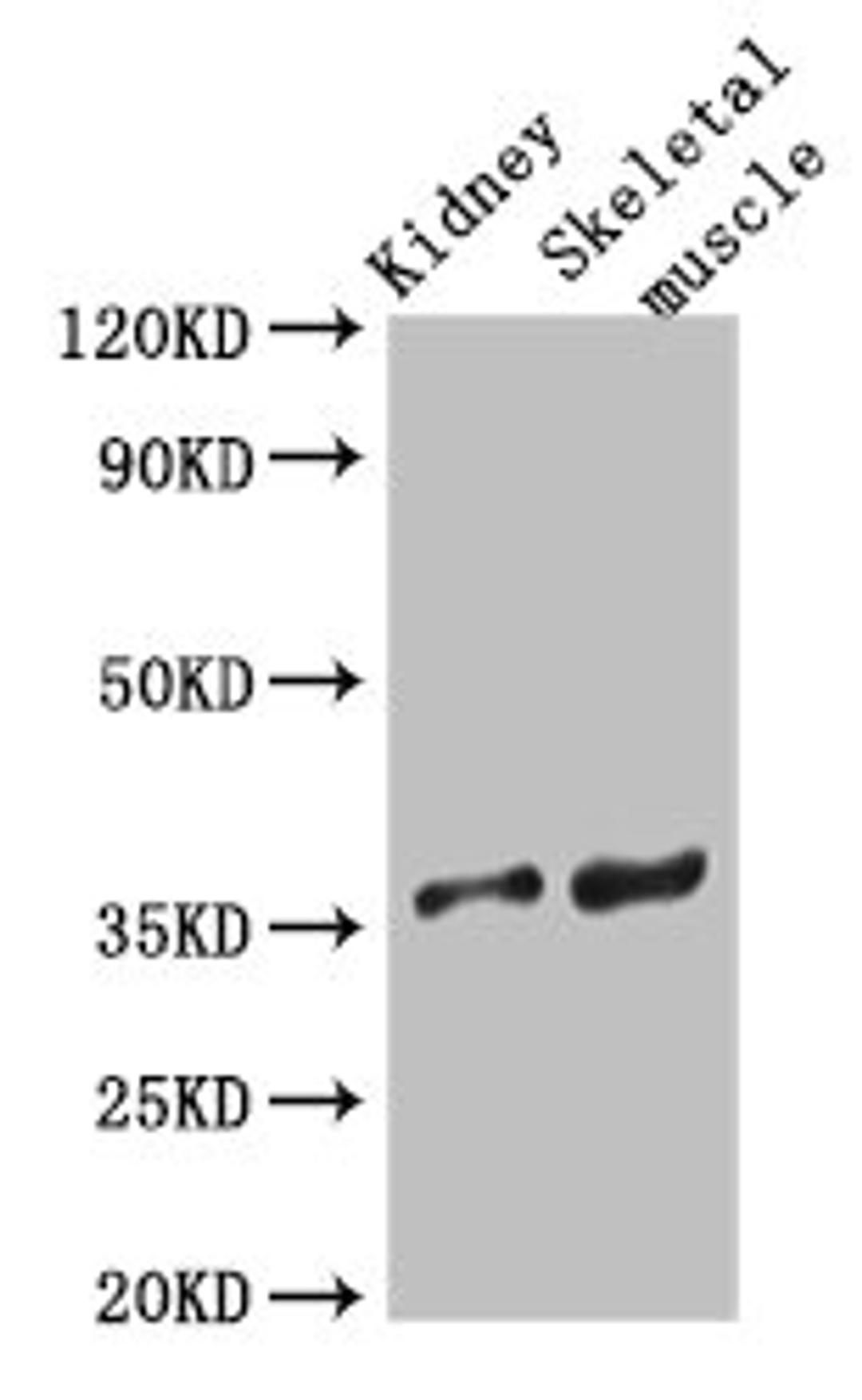 Western Blot. Positive WB detected in: Mouse kidney tissue, Mouse skeletal muscle tissue. All lanes: SLC25A32 antibody at 3µg/ml. Secondary. Goat polyclonal to rabbit IgG at 1/50000 dilution. Predicted band size: 36 kDa. Observed band size: 36 kDa