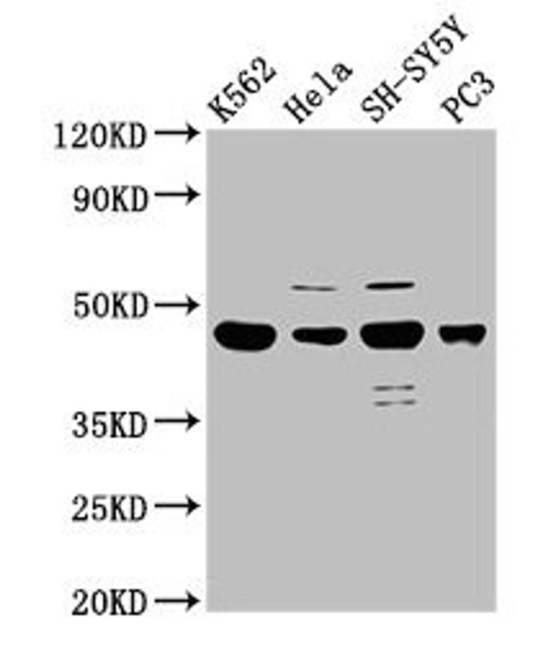 Western Blot. Positive WB detected in: K562 whole cell lysate, Hela whole cell lysate, SH-SY5Y whole cell lysate, PC-3 whole cell lysate. All lanes: LYAR antibody at 2.5ug/ml. Secondary. Goat polyclonal to rabbit IgG at 1/50000 dilution. Predicted band size: 44 kDa. Observed band size: 44 kDa. 