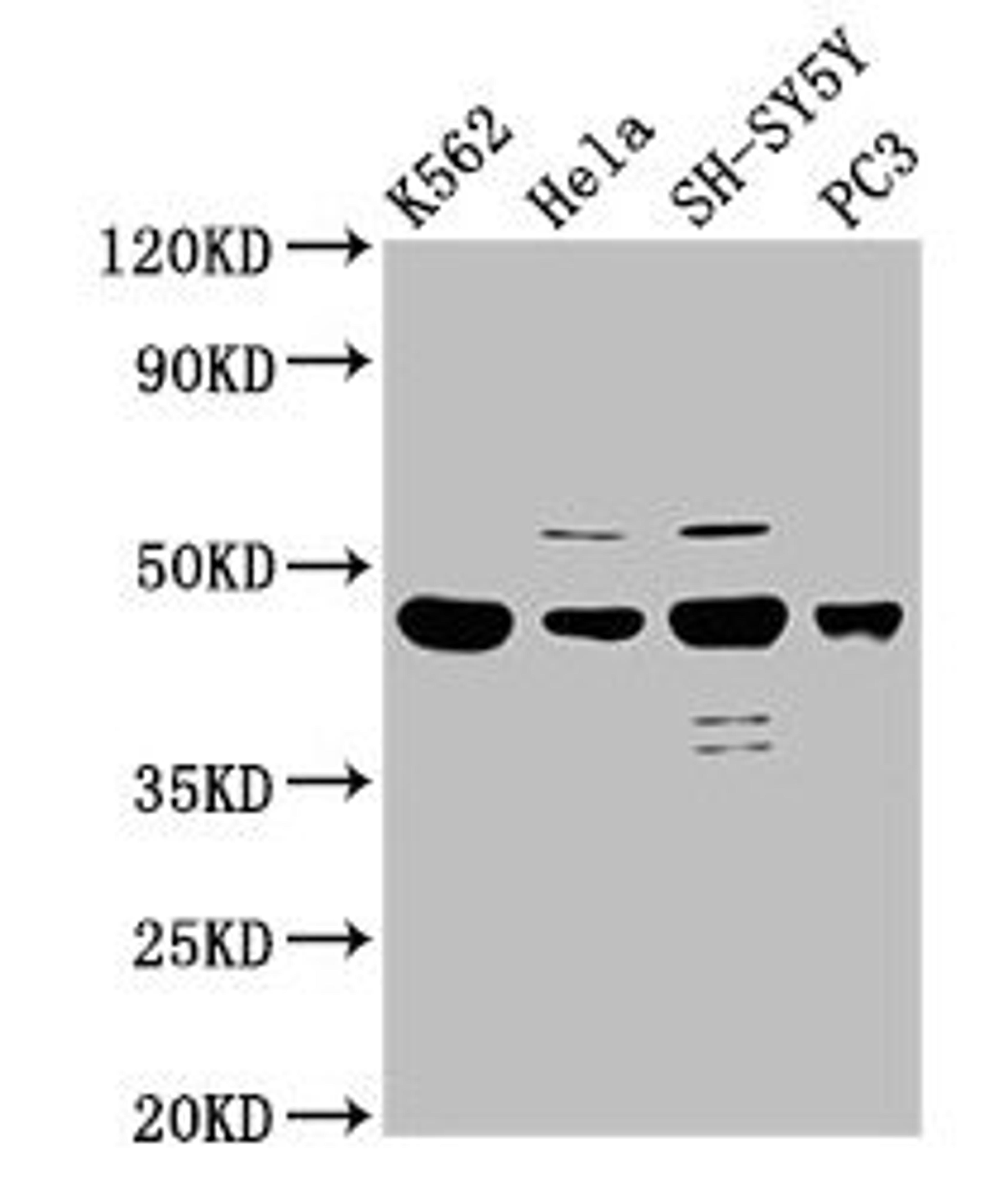 Western Blot. Positive WB detected in: K562 whole cell lysate, Hela whole cell lysate, SH-SY5Y whole cell lysate, PC-3 whole cell lysate. All lanes: LYAR antibody at 2.5ug/ml. Secondary. Goat polyclonal to rabbit IgG at 1/50000 dilution. Predicted band size: 44 kDa. Observed band size: 44 kDa. 