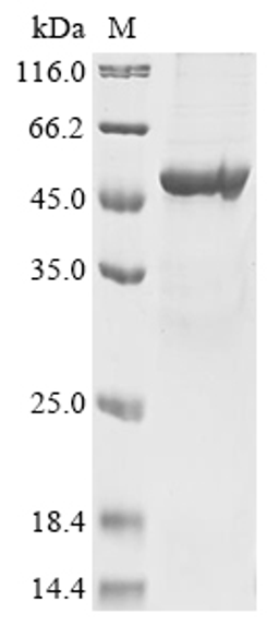 (Tris-Glycine gel) Discontinuous SDS-PAGE (reduced) with 5% enrichment gel and 15% separation gel.