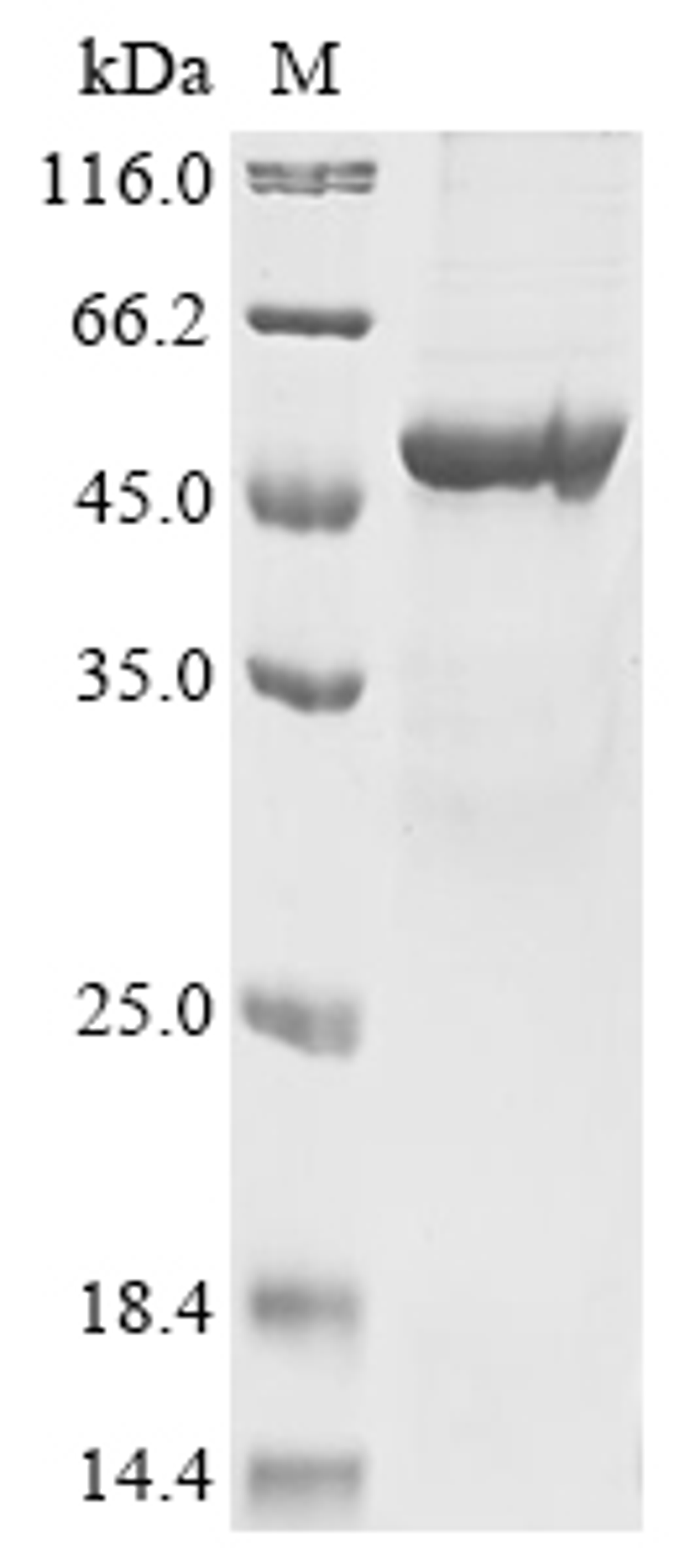 (Tris-Glycine gel) Discontinuous SDS-PAGE (reduced) with 5% enrichment gel and 15% separation gel.