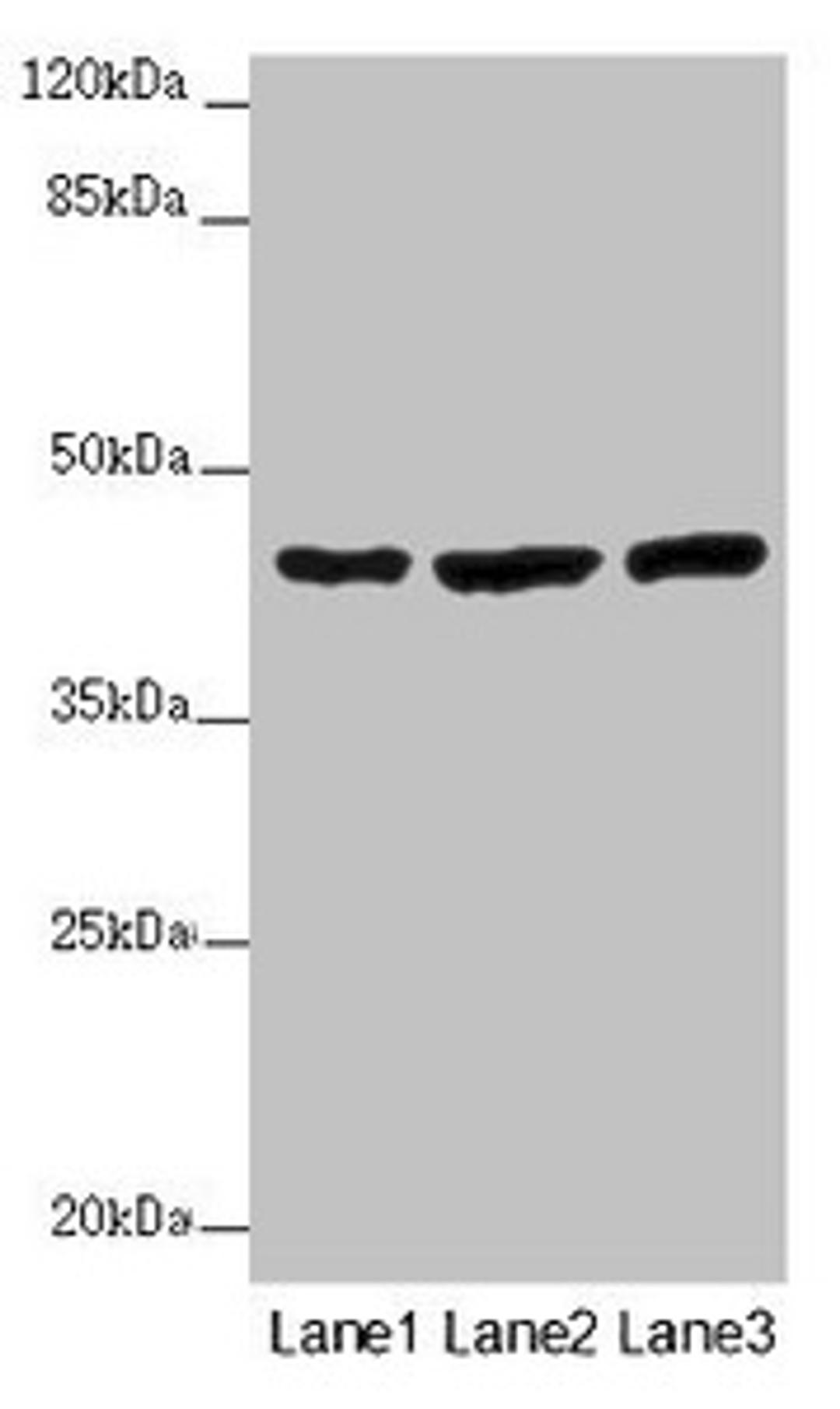Western blot. All lanes: MTERF4 antibody at 2 ug/ml. Lane 1: Mouse kidney tissue. Lane 2: HL60 whole cell lysate. Lane 3: A549 whole cell lysate. Secondary. Goat polyclonal to rabbit IgG at 1/10000 dilution. Predicted band size: 44 kDa. Observed band size: 44 kDa.