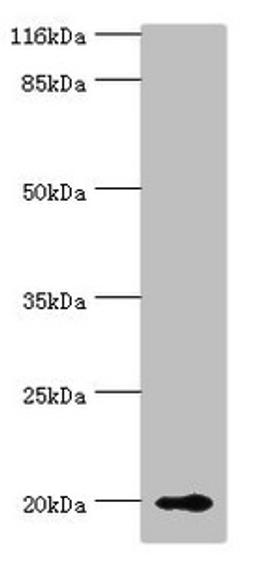 Western blot. All lanes: RBP5 antibody at 8µg/ml + Mouse liver tissue. Secondary. Goat polyclonal to rabbit IgG at 1/10000 dilution. Predicted band size: 16 kDa. Observed band size: 20 kDa