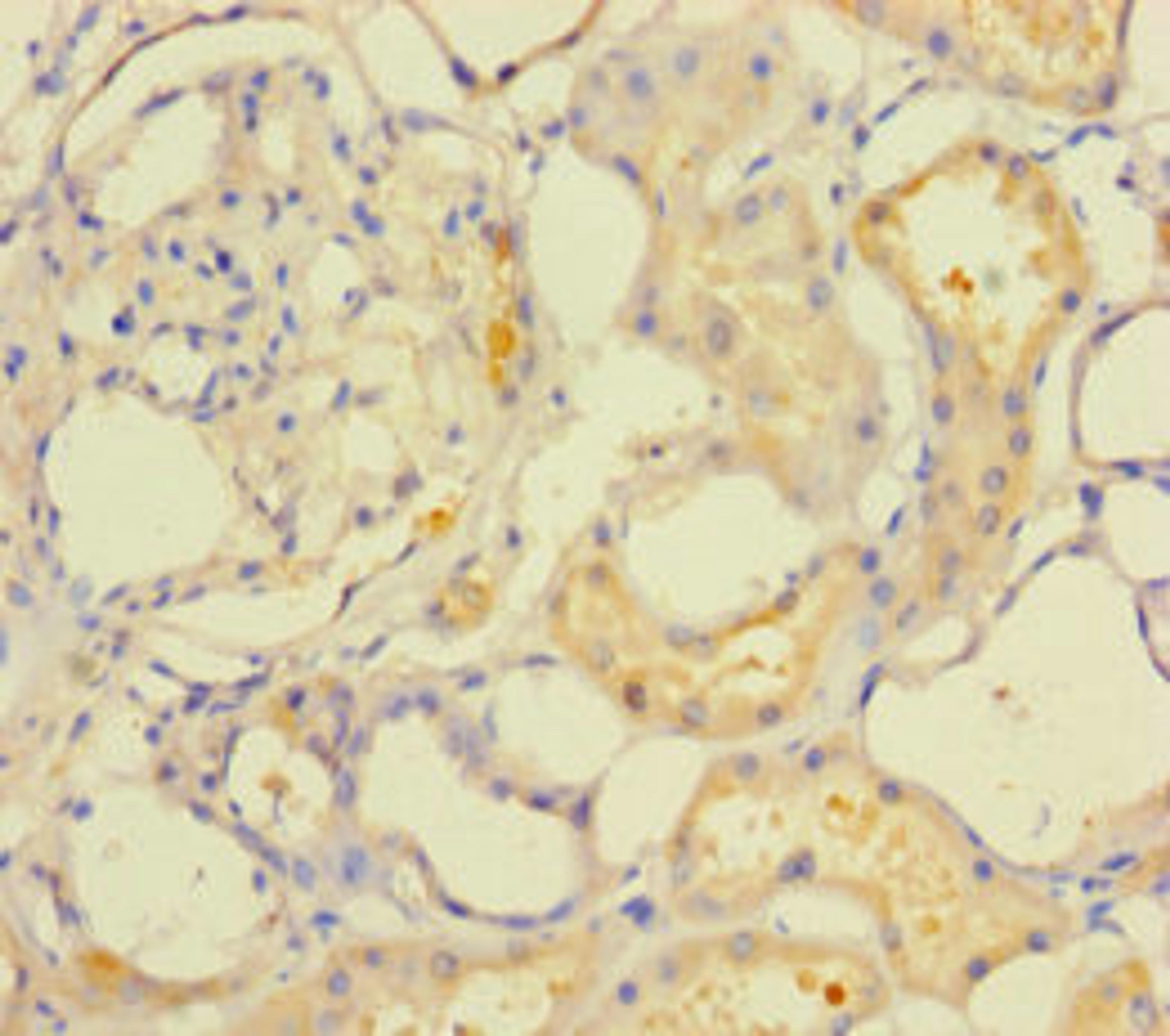 Immunohistochemistry of paraffin-embedded human kidney tissue using CSB-PA668210LA01HU at dilution of 1:100