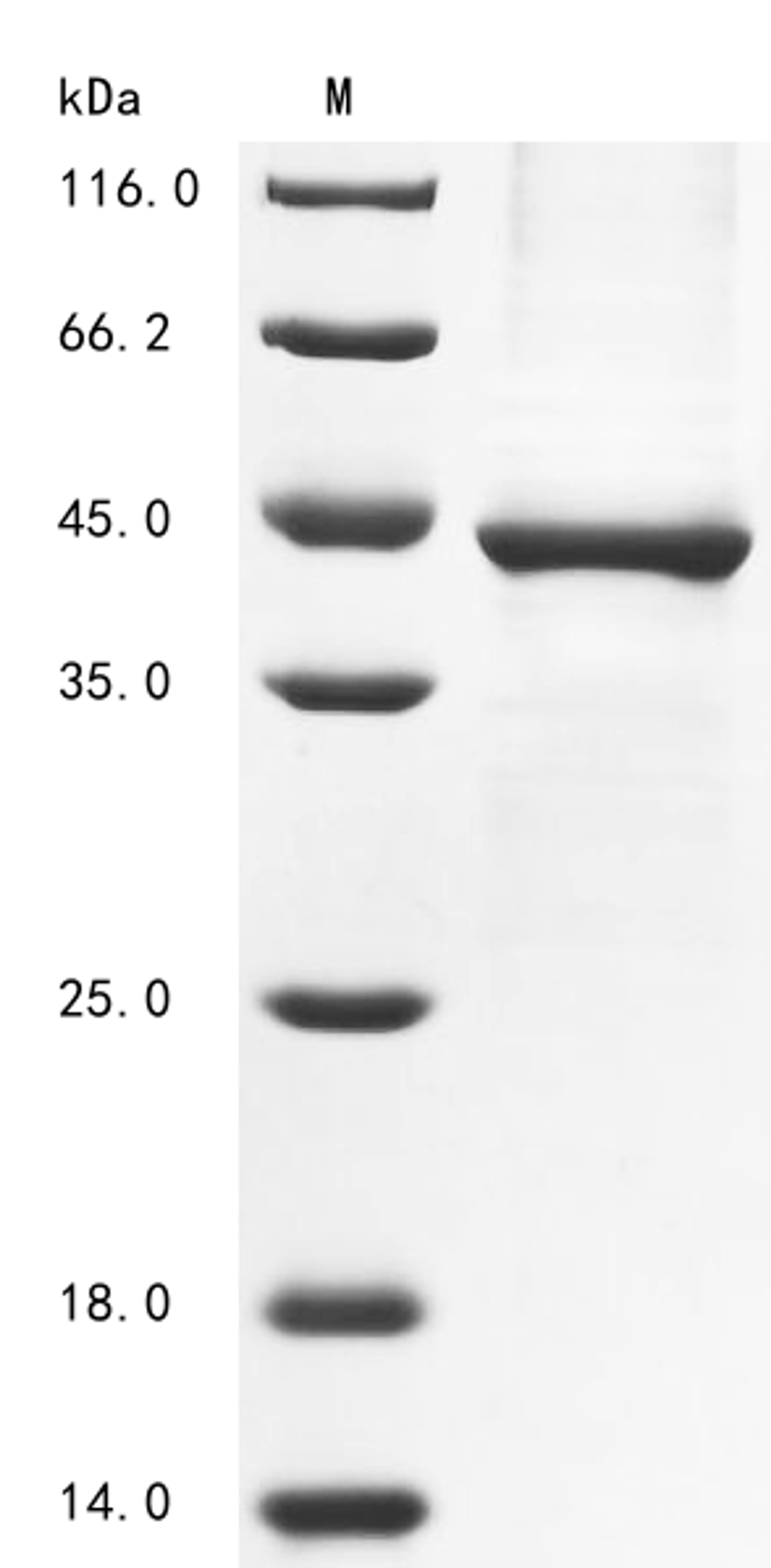 (Tris-Glycine gel) Discontinuous SDS-PAGE (reduced) with 5% enrichment gel and 15% separation gel.