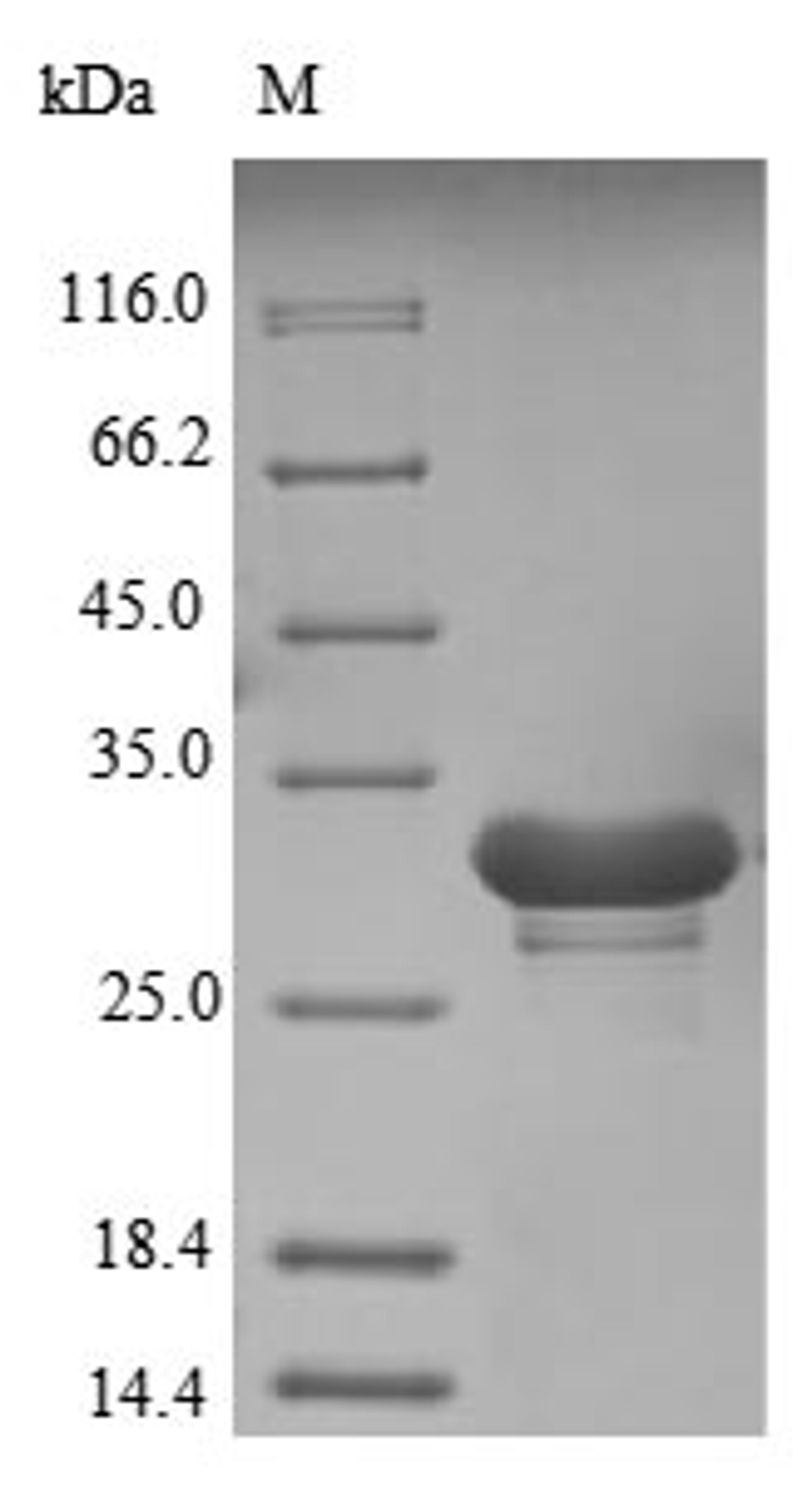 (Tris-Glycine gel) Discontinuous SDS-PAGE (reduced) with 5% enrichment gel and 15% separation gel.