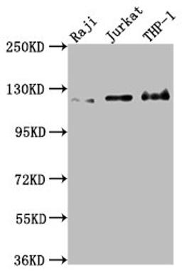 Western Blot. Positive WB detected in: Raji whole cell lysate, Jurkat whole cell lysate, THP-1 whole cell lysate. All lanes: MICAL1 antibody at 1:2000. Secondary. Goat polyclonal to rabbit IgG at 1/50000 dilution. Predicted band size: 118, 109, 38, 120 kDa. Observed band size: 120 kDa.