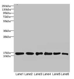Western blot. All lanes: SOD1 antibody at 6µg/ml. Lane 1: Mouse liver tissue. Lane 2: Mouse brain tissue. Lane 3: Hela whole cell lysate. Lane 4: MCF-7 whole cell lysate. Lane 5: A549 whole cell lysate. Lane 6: HepG2 whole cell lysate. Secondary. Goat polyclonal to rabbit IgG at 1/10000 dilution. Predicted band size: 16 kDa. Observed band size: 16 kDa