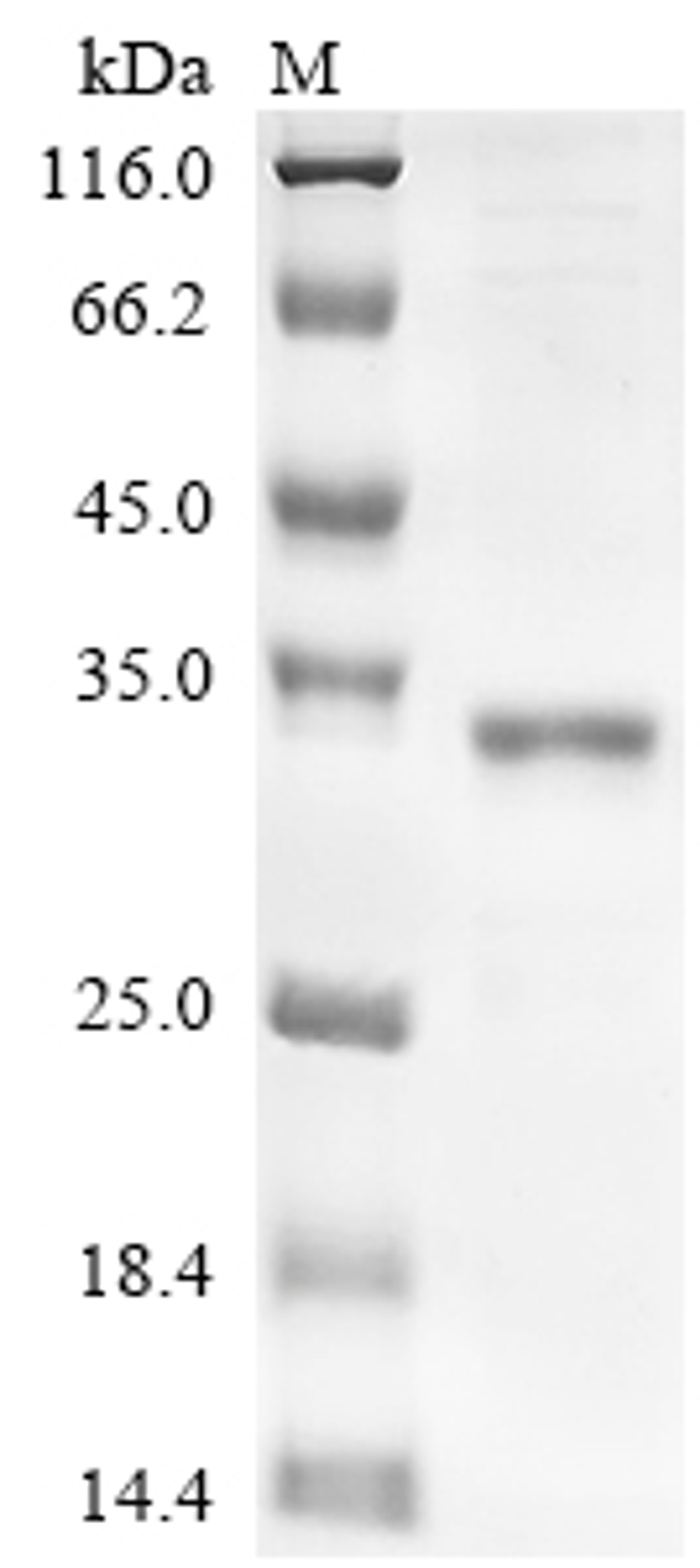 (Tris-Glycine gel) Discontinuous SDS-PAGE (reduced) with 5% enrichment gel and 15% separation gel.