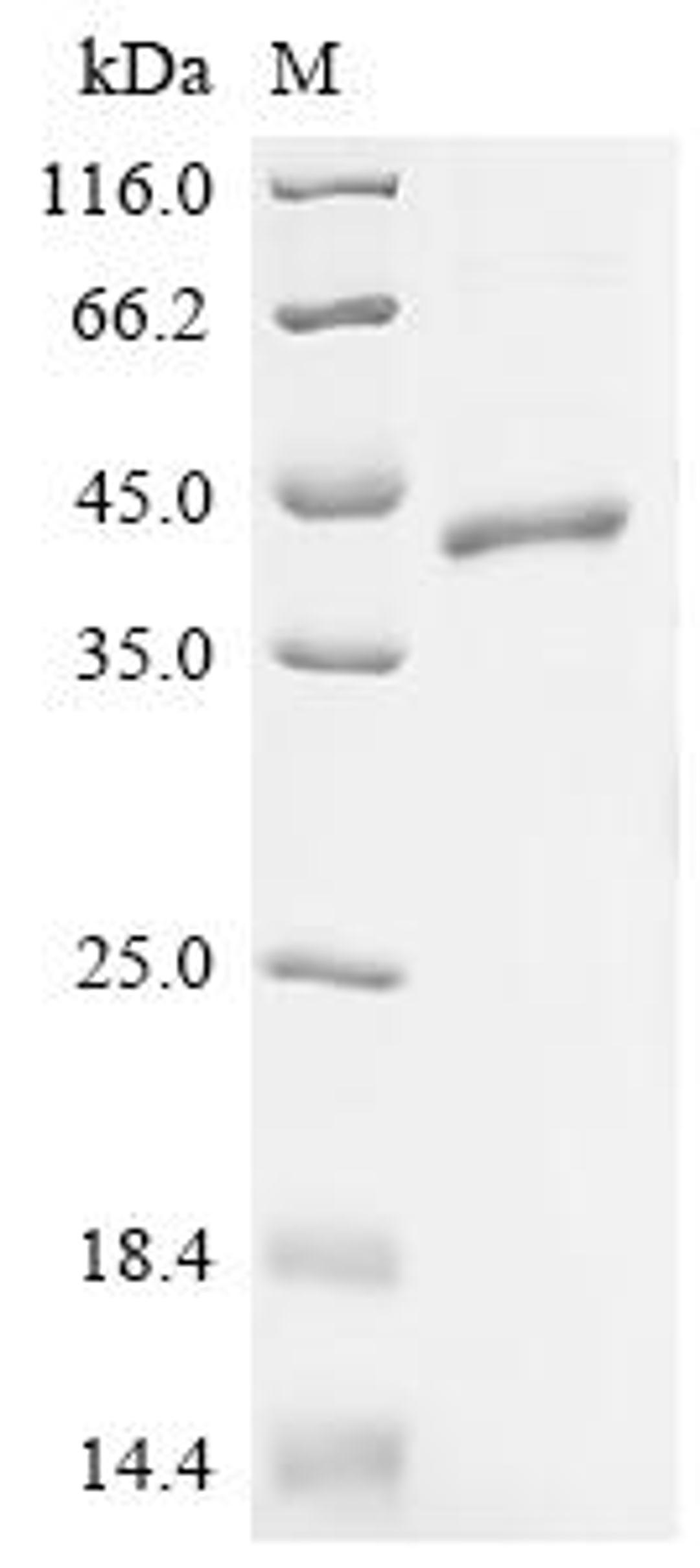 (Tris-Glycine gel) Discontinuous SDS-PAGE (reduced) with 5% enrichment gel and 15% separation gel.