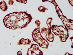 IHC image of CSB-PA836204LA01HU diluted at 1:400 and staining in paraffin-embedded human placenta tissue performed on a Leica BondTM system. After dewaxing and hydration, antigen retrieval was mediated by high pressure in a citrate buffer (pH 6.0). Section was blocked with 10% normal goat serum 30min at RT. Then primary antibody (1% BSA) was incubated at 4&deg;C overnight. The primary is detected by a biotinylated secondary antibody and visualized using an HRP conjugated SP system.