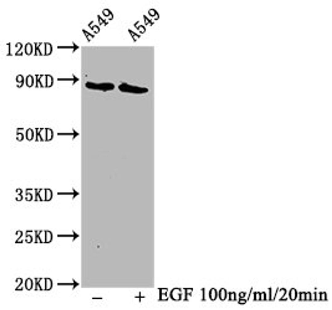Western Blot. Positive WB detected in A549 whole cell lysate(treated with EGF or not). All lanes Phospho-BRAF antibody at 1.3μg/ml. Secondary. Goat polyclonal to rabbit IgG at 1/50000 dilution. Predicted band size: 85 KDa. Observed band size: 85 KDa. 
