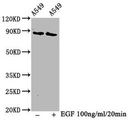 Western Blot. Positive WB detected in A549 whole cell lysate(treated with EGF or not). All lanes Phospho-BRAF antibody at 1.3μg/ml. Secondary. Goat polyclonal to rabbit IgG at 1/50000 dilution. Predicted band size: 85 KDa. Observed band size: 85 KDa. 