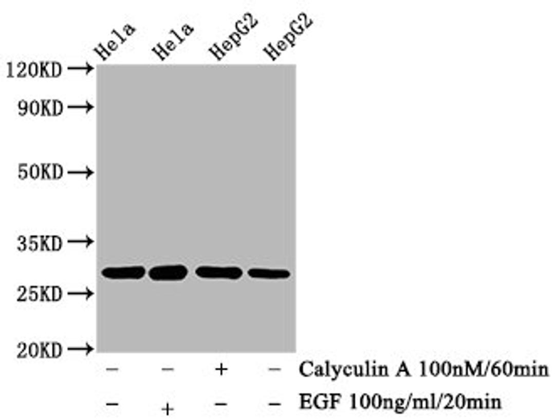 Western Blot. Positive WB detected in Hela whole cell lysate锛孒epG2 whole cell lysate(treated with Calyculin A or EGF). All lanes Phospho-HSPB1 antibody at 0.73μg/ml. Secondary. Goat polyclonal to rabbit IgG at 1/50000 dilution. Predicted band size: 27 KDa. Observed band size: 27 KDa.