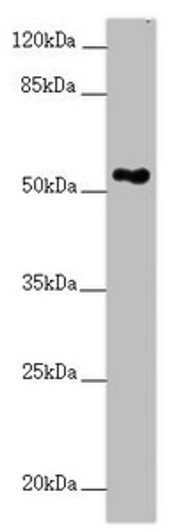 Western blot. All lanes: FOXRED1 antibody at 5.28µg/ml + A549 whole cell lysate. Secondary. Goat polyclonal to rabbit IgG at 1/10000 dilution. Predicted band size: 54, 31, 53 kDa. Observed band size: 54 kDa