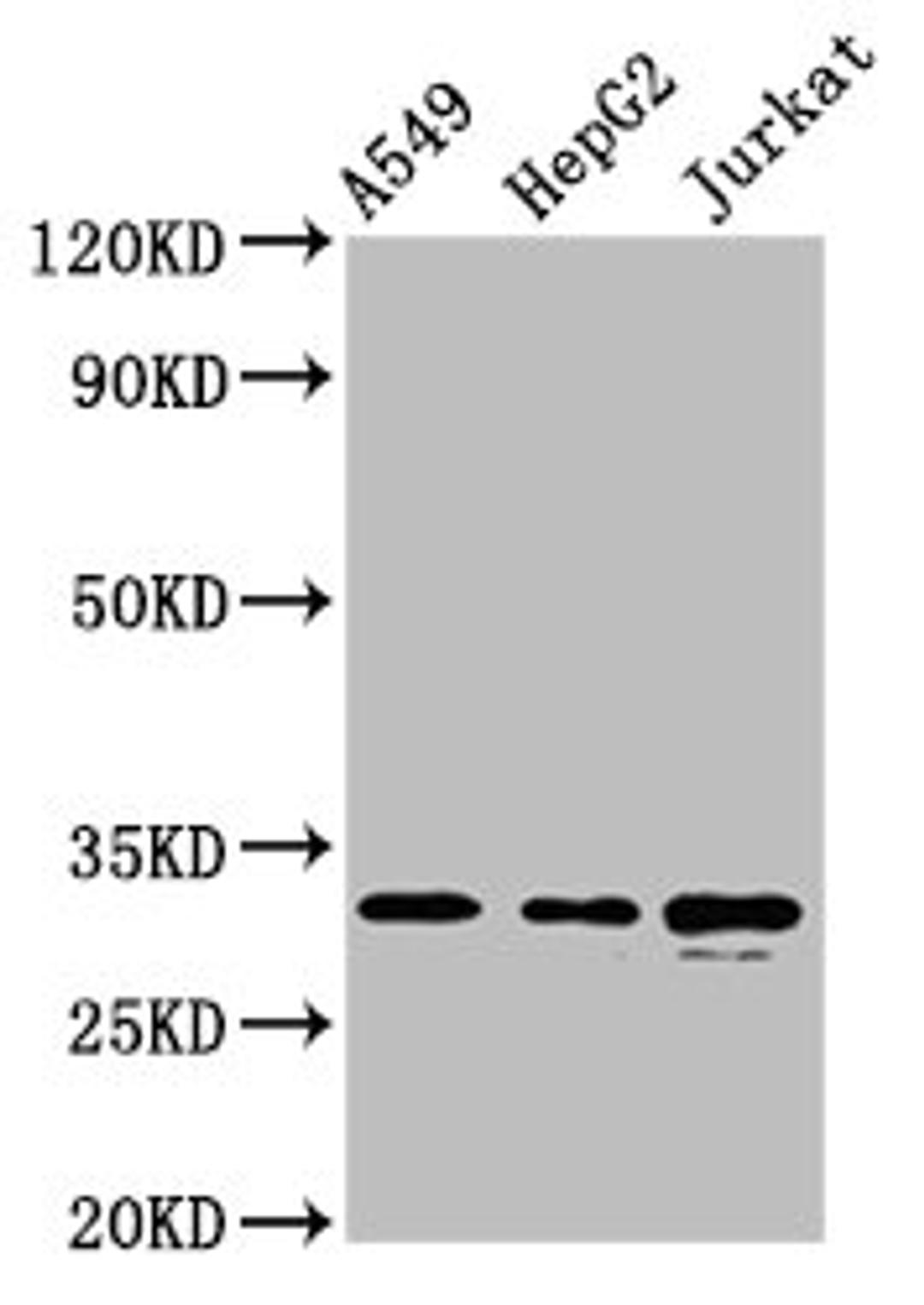 Western Blot. Positive WB detected in: A549 whole cell lysate, HepG2 whole cell lysate, Jurkat whole cell lysate. All lanes: RALY antibody at 5.7µg/ml. Secondary. Goat polyclonal to rabbit IgG at 1/50000 dilution. Predicted band size: 33, 31 kDa. Observed band size: 33 kDa