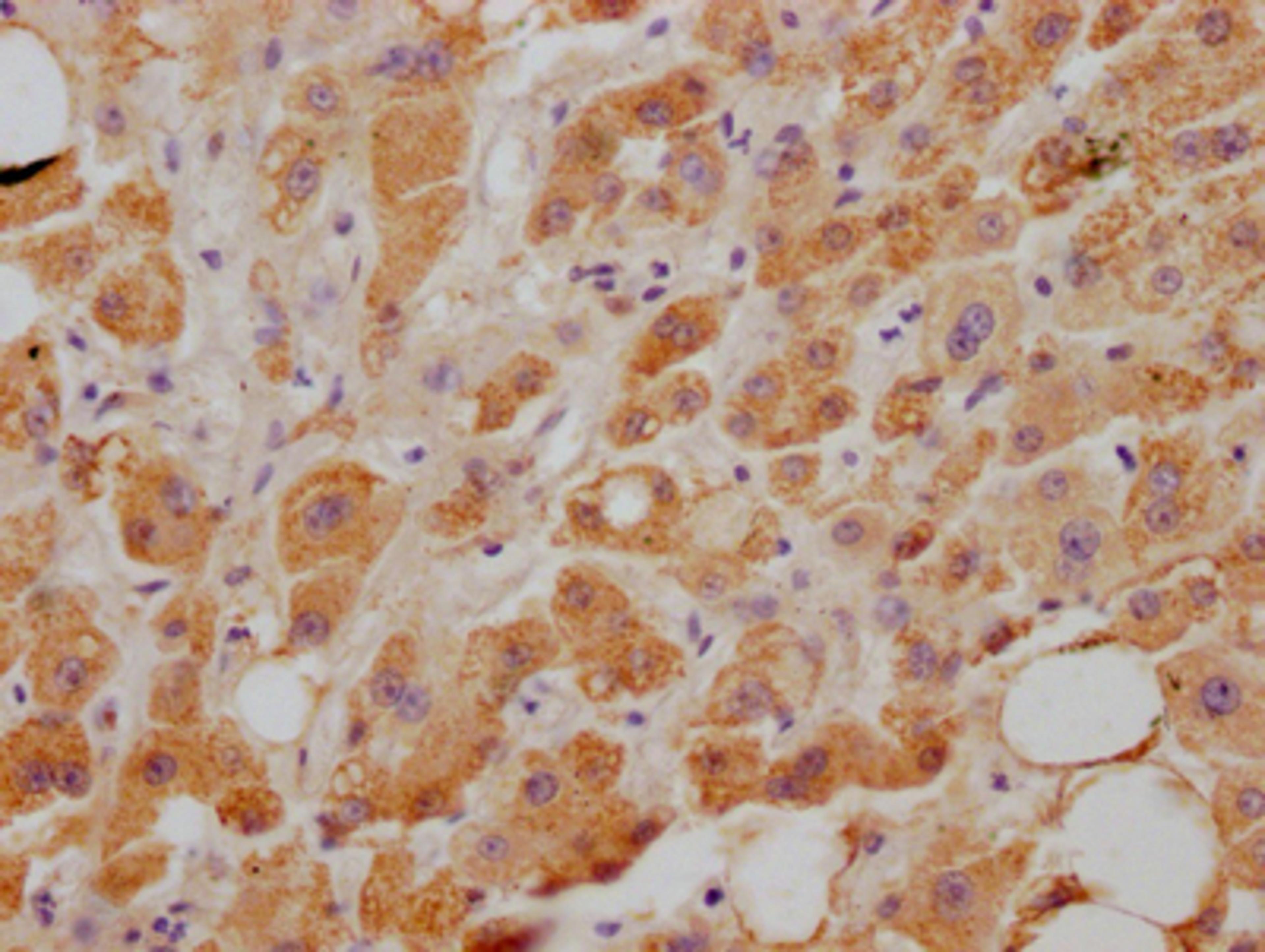 IHC image of CSB-RA921474A0HU diluted at 1:100 and staining in paraffin-embedded human liver tissue performed on a Leica BondTM system. After dewaxing and hydration, antigen retrieval was mediated by high pressure in a citrate buffer (pH 6.0). Section was blocked with 10% normal goat serum 30min at RT. Then primary antibody (1% BSA) was incubated at 4℃ overnight. The primary is detected by a Goat anti-rabbit IgG polymer labeled by HRP and visualized using 0.05% DAB.