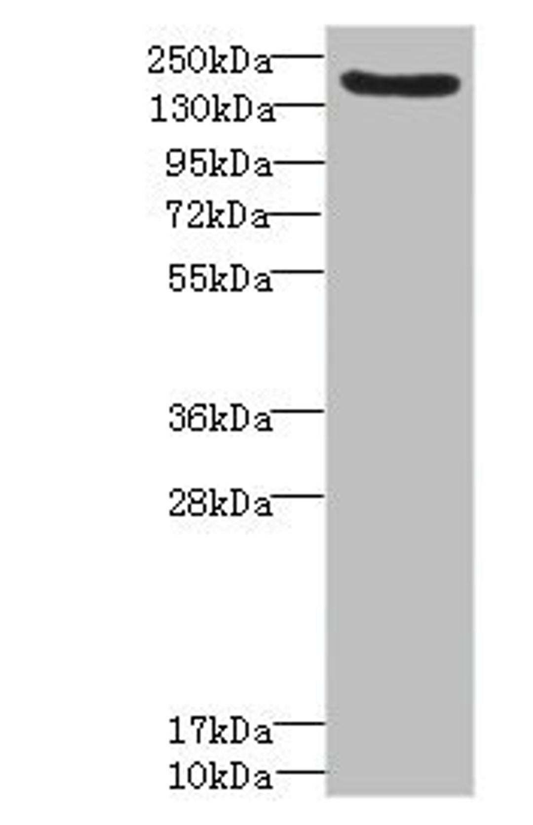Western blot. All lanes: LY75 antibody IgG at 1.57ug/ml + Mouse liver tissue. Secondary. Goat polyclonal to rabbit IgG at 1/10000 dilution. Predicted band size: 199, 216, 20, 210 kDa. Observed band size: 199 kDa. 