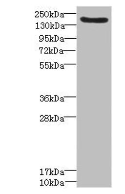 Western blot. All lanes: LY75 antibody IgG at 1.57ug/ml + Mouse liver tissue. Secondary. Goat polyclonal to rabbit IgG at 1/10000 dilution. Predicted band size: 199, 216, 20, 210 kDa. Observed band size: 199 kDa. 