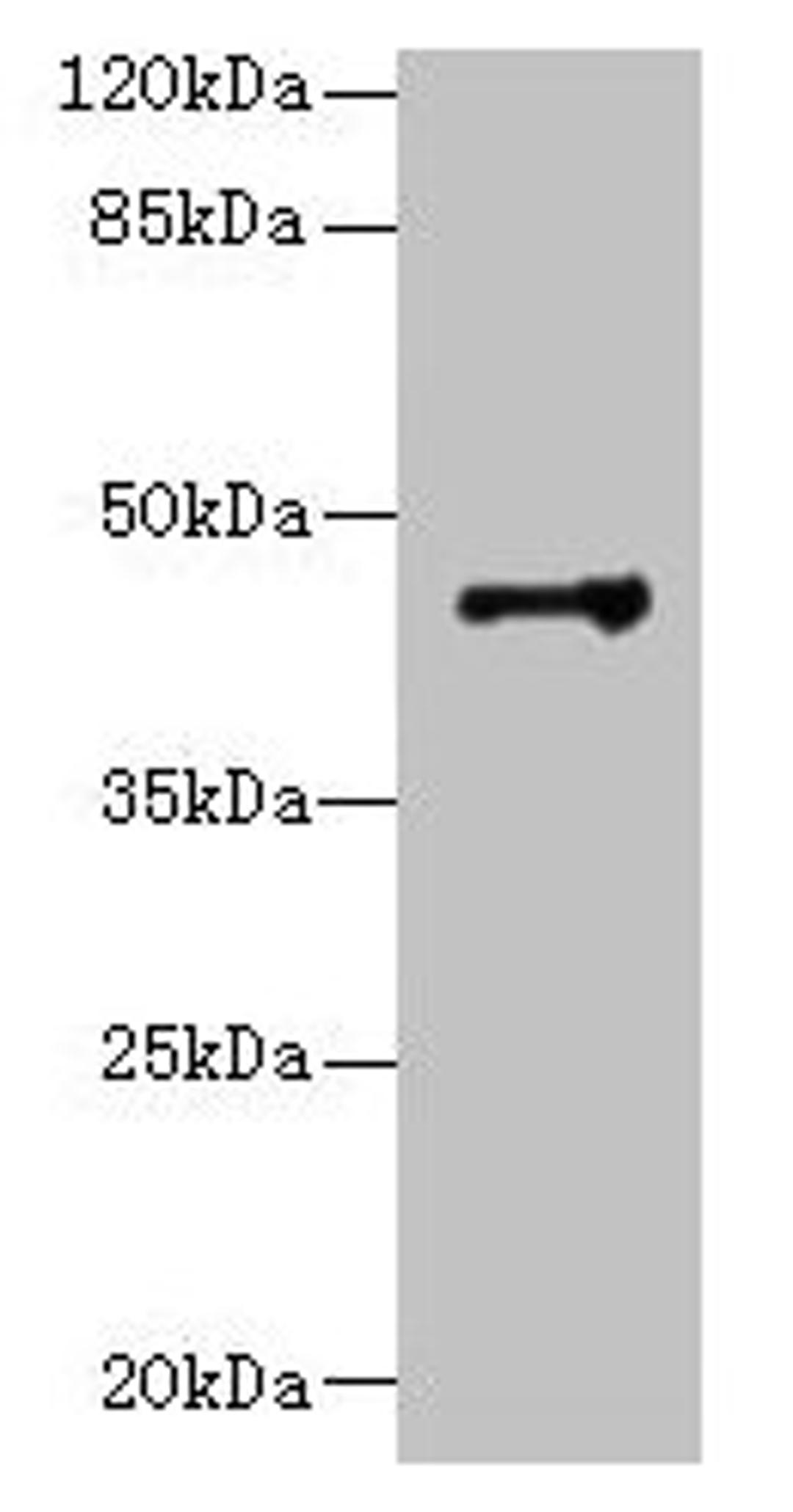 Western blot. All lanes: DSCC1 antibody at 8µg/ml + CEM whole cell lysate. Secondary. Goat polyclonal to rabbit IgG at 1/10000 dilution. Predicted band size: 45 kDa. Observed band size: 45 kDa
