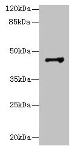 Western blot. All lanes: DSCC1 antibody at 8µg/ml + CEM whole cell lysate. Secondary. Goat polyclonal to rabbit IgG at 1/10000 dilution. Predicted band size: 45 kDa. Observed band size: 45 kDa