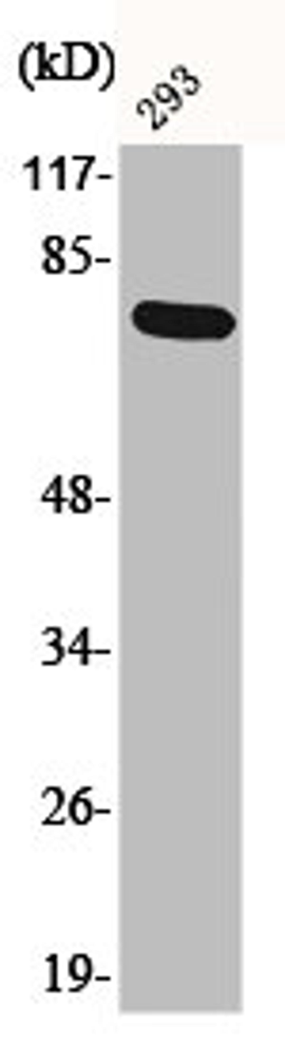 Western Blot analysis of 293 cells using Phospho-LIMK-1 (T508) Polyclonal Antibody