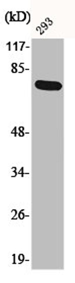 Western Blot analysis of 293 cells using Phospho-LIMK-1 (T508) Polyclonal Antibody